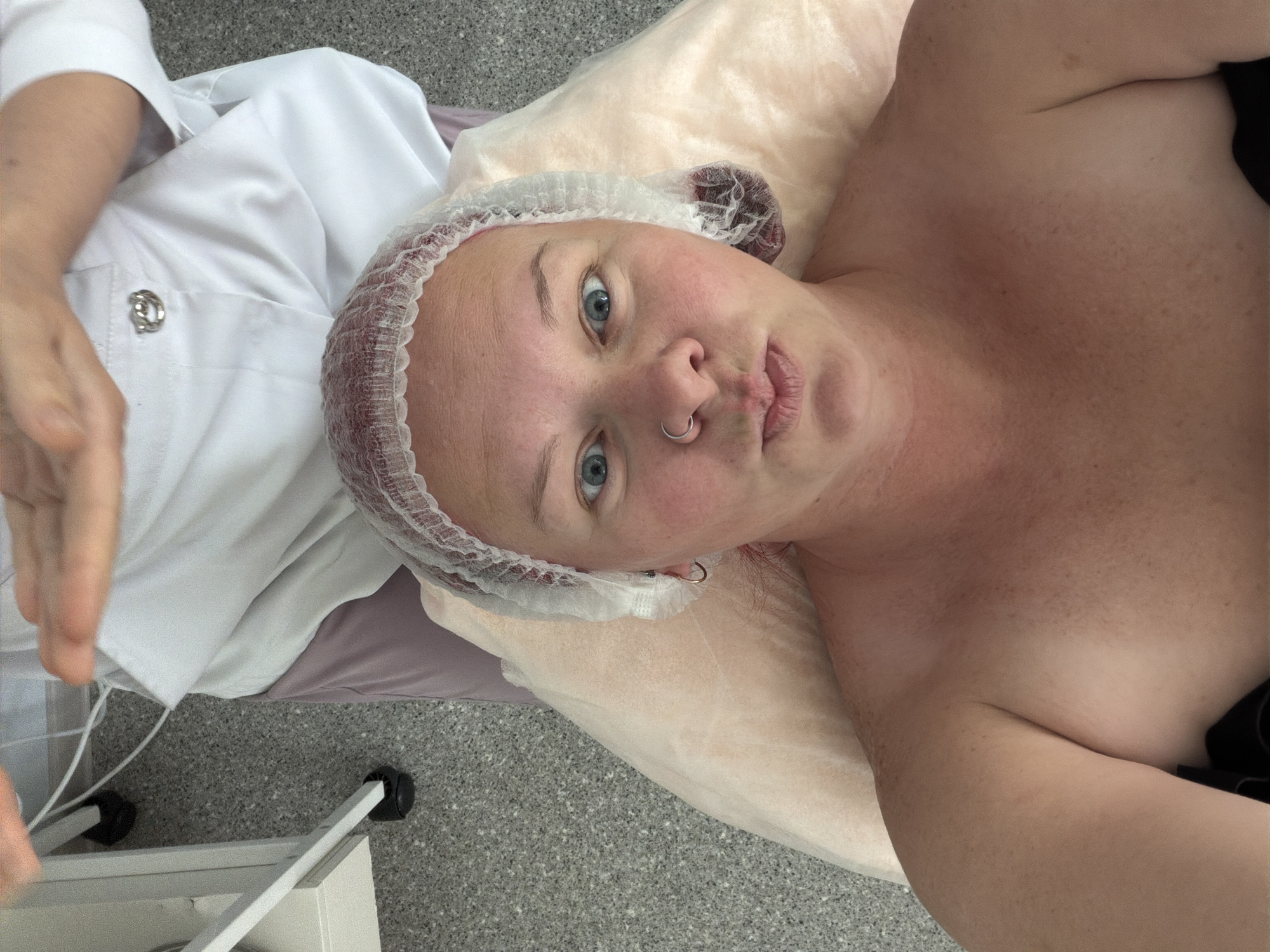 This indoor image captures a scene in what appears to be a medical or aesthetic treatment room in Chaikovsky, Russia. The primary subject is a person lying down, looking directly at the camera, seemingly taking a selfie or being photographed. This individual wears a white disposable hairnet, revealing blue eyes, a nose piercing, and lightly puckered lips. Their chest and shoulders are bare, showing freckles.
On the left side of the frame, a second person, likely a professional such as a cosmetologist or doctor, is partially visible. They are wearing a white uniform or lab coat, with a silver, stylized pin or logo on the lapel. Their hand is seen extended, possibly gesturing or preparing for a procedure.
The patient is positioned on a bed or examination table covered with a light-colored disposable sheet. The floor is a light grey with a speckled texture, commonly found in clinical environments. A portion of a white, wheeled medical cart or bed frame is visible in the lower left corner. The overall setting suggests a pre-treatment or consultation scenario. No explicit text is clearly readable, though the silver pin on the professional's uniform appears to be a logo.