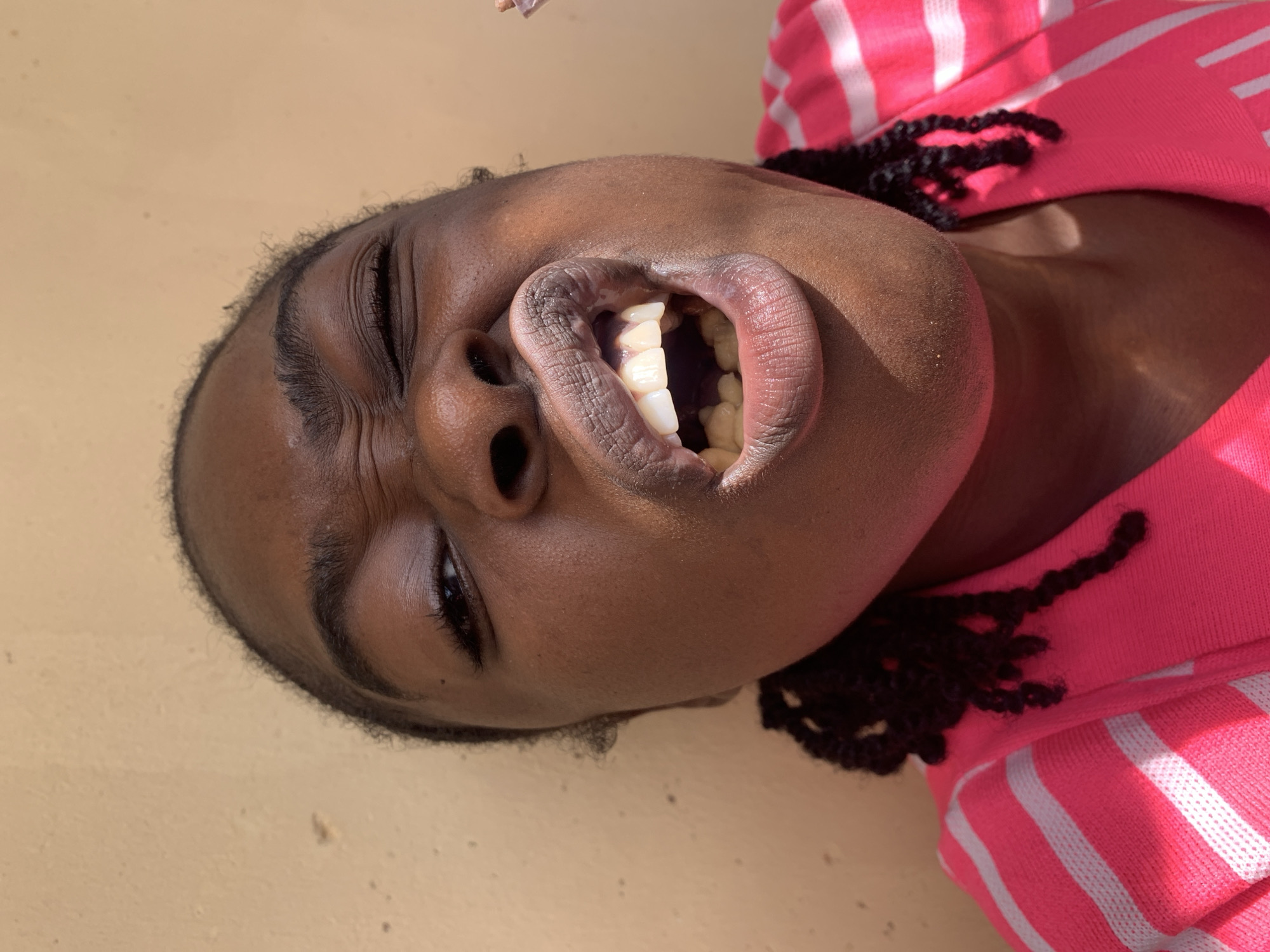 A close-up, eye-level portrait features a young individual with dark skin against a plain, light brown wall. The subject's face is contorted in an expressive grimace: the right eye (viewer's left) is wide open, while the left eye (viewer's right) is squinted shut, causing deep wrinkles around it. The eyebrows are furrowed. The nose is visibly crinkled. The mouth is open wide in an "O" shape, exposing the upper incisors and some lower teeth. The lips are full. Dark, braided hair is visible around the sides of the head and on the shoulders. The individual wears a bright pink top with prominent horizontal white stripes. Strong, directional lighting, consistent with sunlight, illuminates the subject from the left, casting distinct shadows and highlighting facial contours. No other people or specific location markers are discernible in the image.
