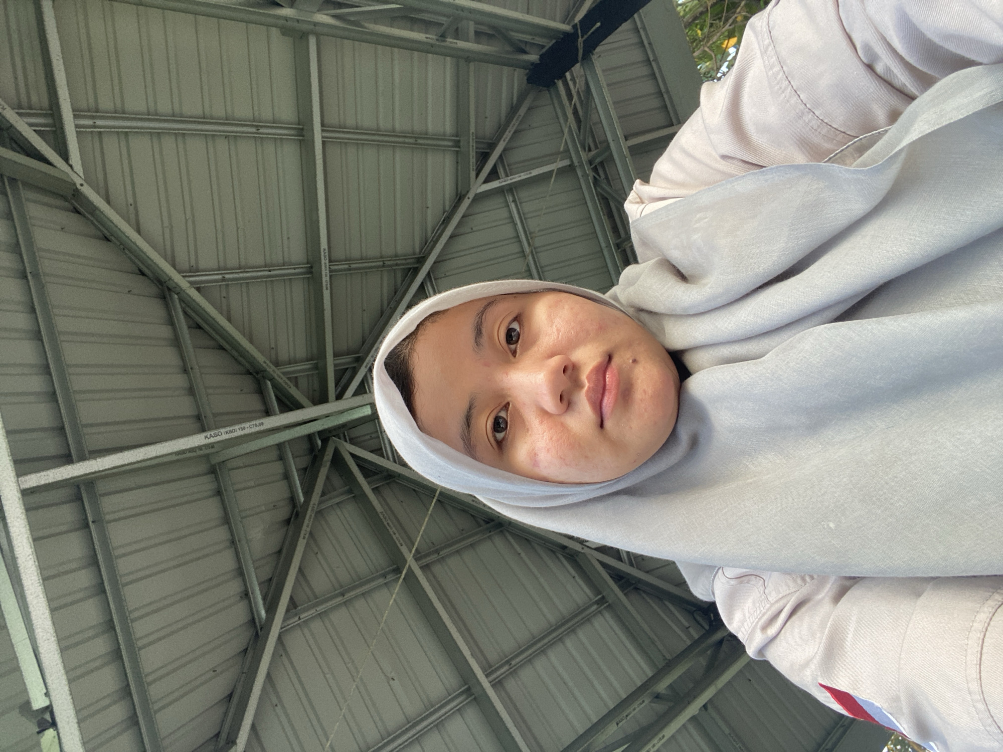 The image is a low-angle, close-up, selfie-style photograph of a young woman wearing a light grey hijab and a pale pink jacket. She is looking directly at the camera with a neutral expression. Her skin shows some redness and minor blemishes on her cheeks. The background is dominated by the underside of a metal roof structure, supported by a network of metal beams and trusses. The roof appears to be corrugated. The overall setting suggests an outdoor shelter or pavilion. There are some faint reflections and shadows on the metal surfaces. The flag of Indonesia is visible on the left shoulder of her jacket. The scene does not provide specific clues to pinpoint the exact location within Banjarbaru, Indonesia, beyond the general context of an outdoor public space with a shelter.