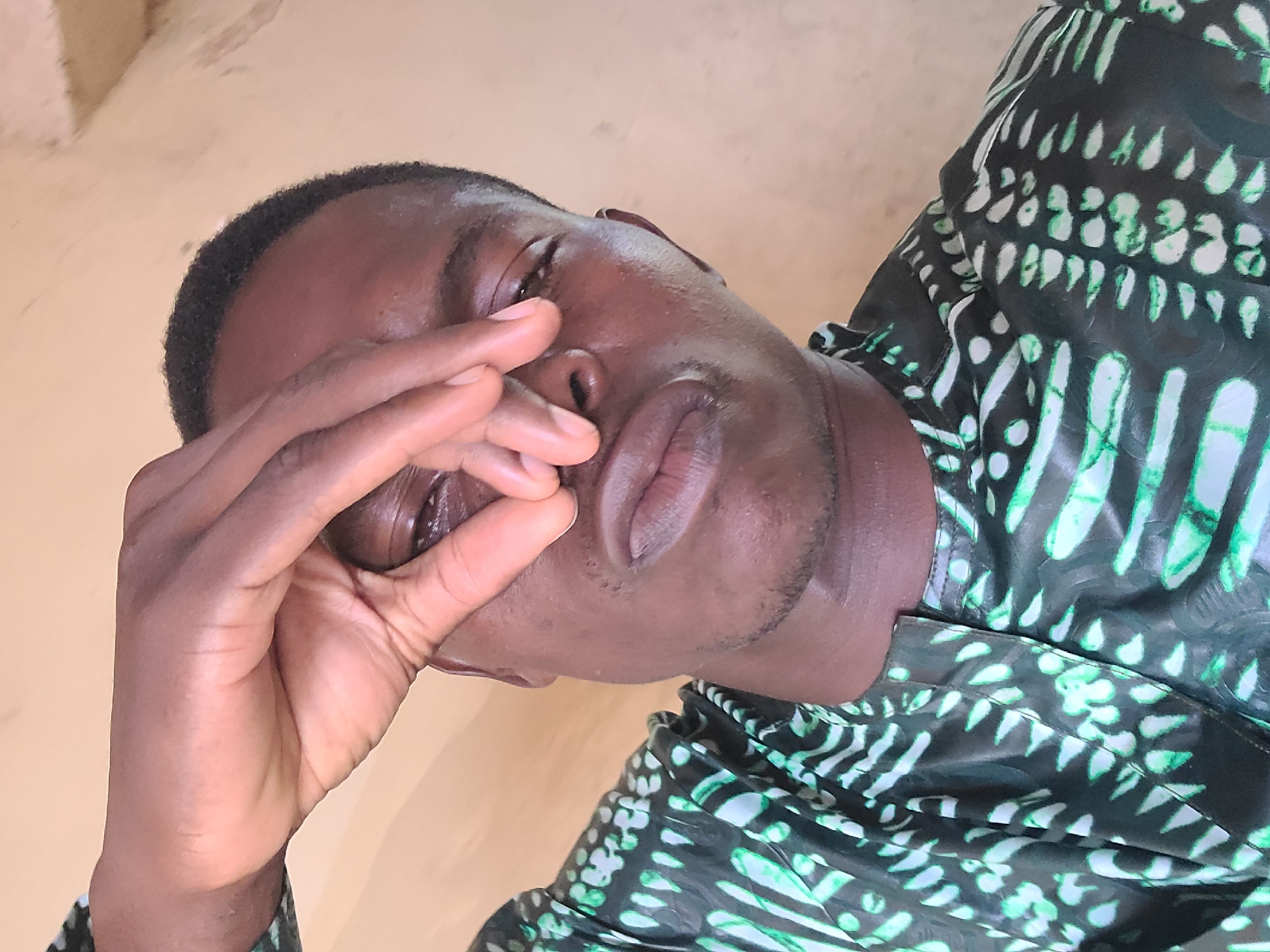 The image shows a close-up, high-angle shot of a young Black man's face in Gura Top, Nigeria. He is wearing a dark green and white patterned shirt. His right hand is raised, obscuring part of his face and eyes, with his fingers pinching his nose. His lips are slightly parted, and his eyes are partially visible. The background is a plain, light-colored wall.