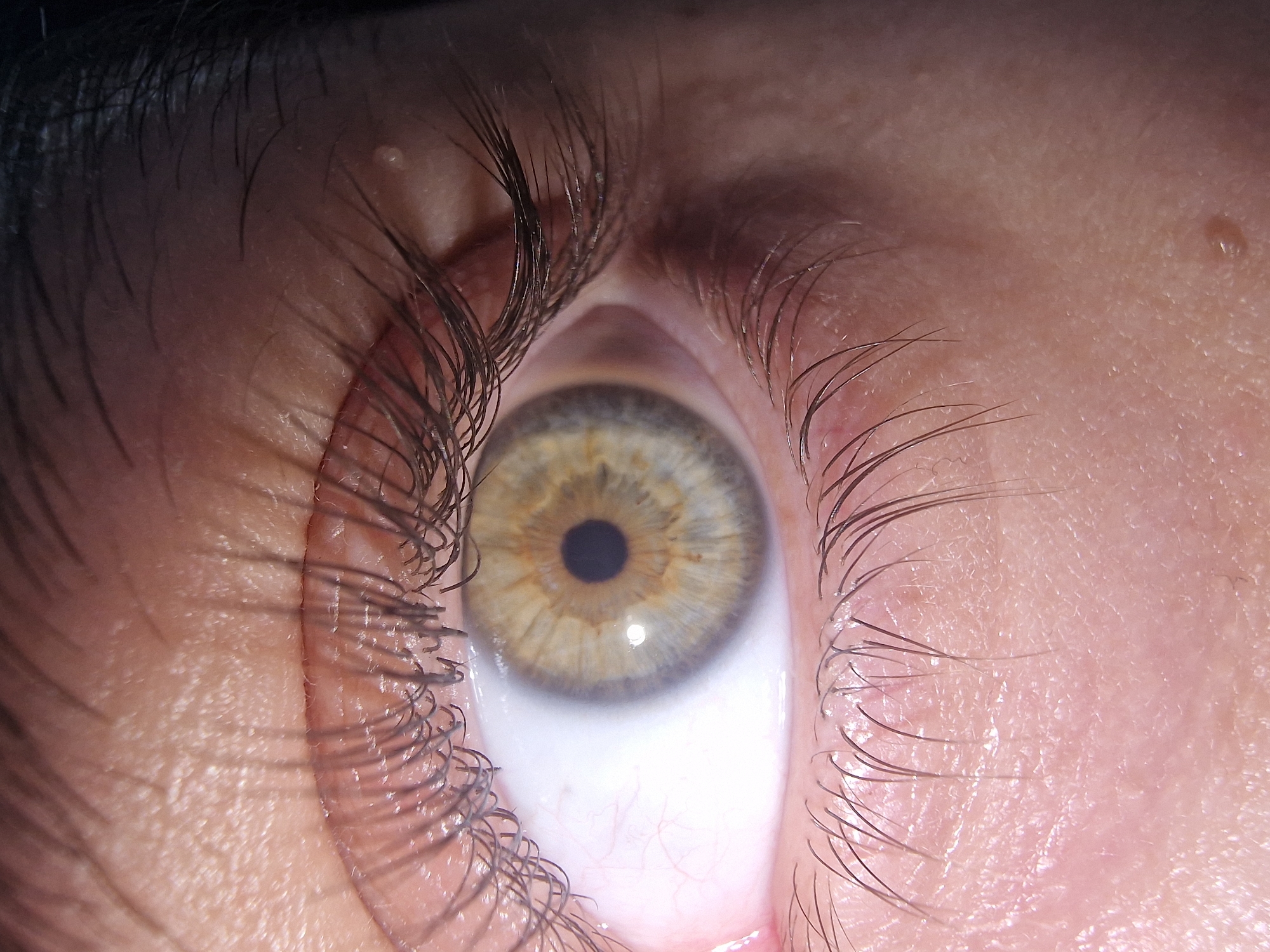 A close-up photograph captures a human eye, positioned looking upwards. The eye has a hazel iris with a dark pupil. Eyelashes are visible surrounding the eye. The skin around the eye shows texture and some freckles. No specific location can be discerned from the image.