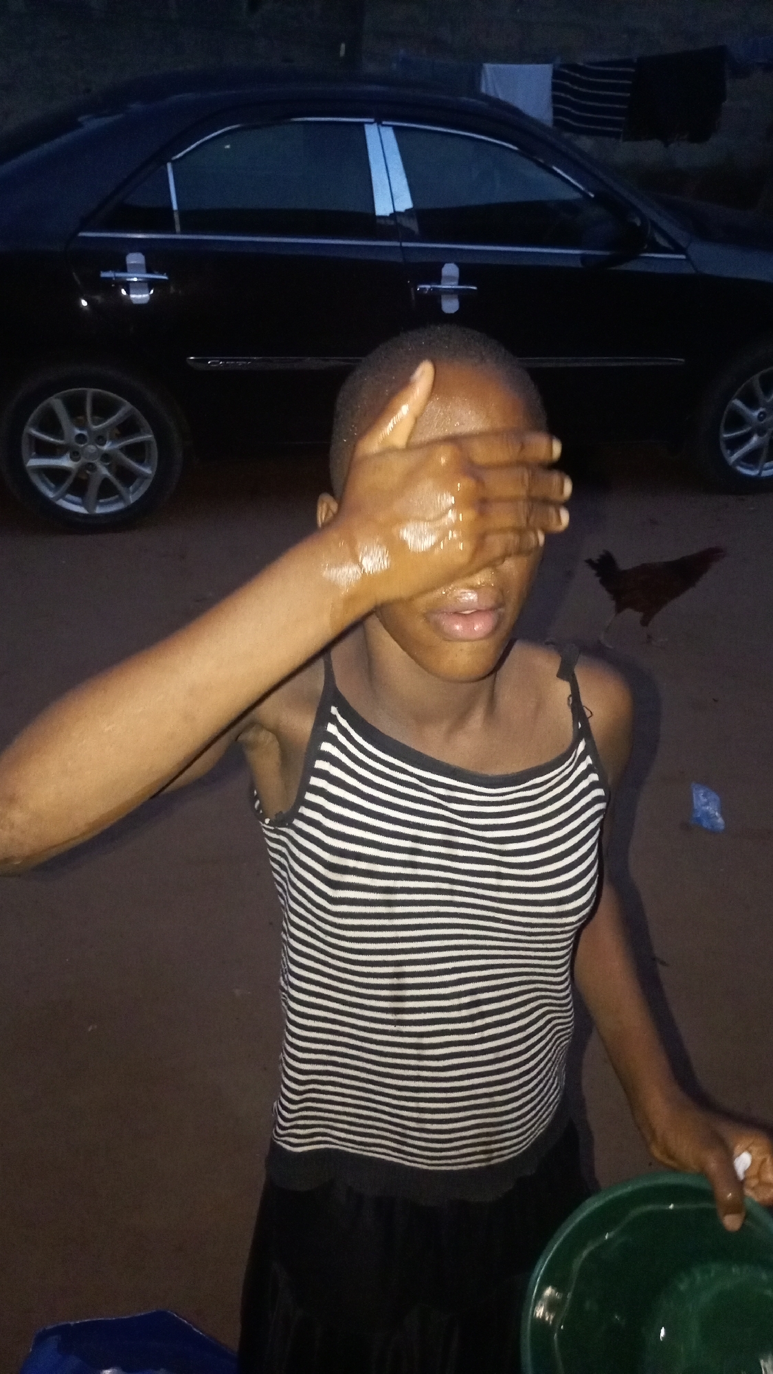 A person stands outside with a dark car visible in the background. The individual is wearing a striped tank top and a dark skirt. They have one arm extended, covering their eyes with their hand. Their skin appears to be wet. The other arm is holding a green basin. In the background, a chicken is visible, and there are also what appear to be clothes hanging. The location appears to be a dirt or gravel area.