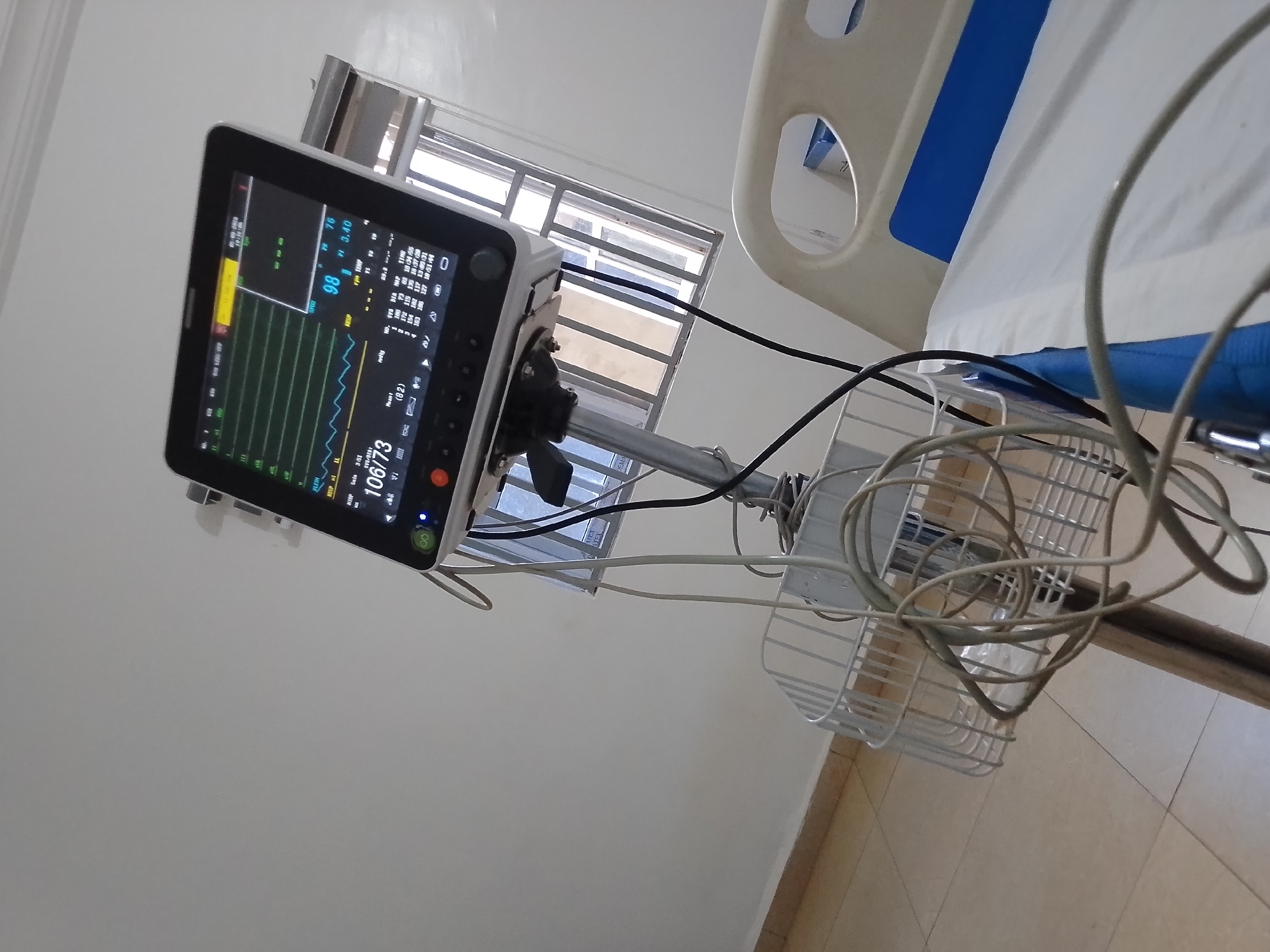 A hospital room scene in Sabon Tasha, Nigeria. A medical monitor displaying vital signs sits on a stand next to a hospital bed. The monitor displays a heart rate of 98 and blood pressure of 106/73. The bed has blue accents. A window is visible in the background. White medical cables are bundled in a basket attached to the monitor stand. The room has white walls and beige floor tiles. No people are visible.