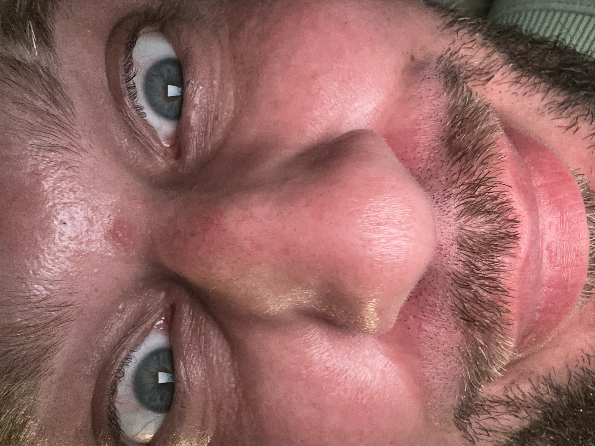 A close-up, low-angle, selfie-style photograph taken in the Zvezdara Urban Municipality, Serbia, shows a person's face filling the frame. The subject's eyes are wide open and looking directly at the camera, with a square reflection visible in each pupil. The skin appears reddish and slightly oily, with visible pores and fine hairs. The nose is prominent in the center of the image, and the mouth is slightly open, revealing the lower lip. A sparse beard and mustache are present, with dark hairs contrasting against the skin. The lighting is bright, creating highlights on the skin and in the eyes. The background is out of focus and appears to be a textured green surface.