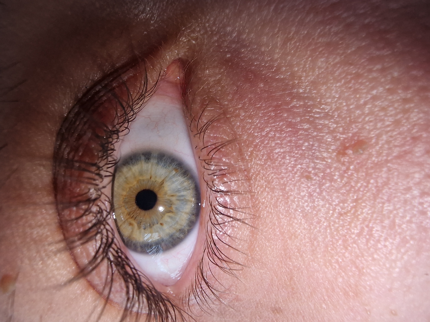 This is an extreme close-up, high-angle shot of a human eye, focusing primarily on the iris, pupil, and surrounding skin. The eye is open, revealing a multi-colored iris that appears hazel or green with central heterochromia, featuring a warm golden-brown ring around the pupil that transitions into a lighter blue-gray or greenish-blue towards the outer edge. The pupil is dark and round, with a small, bright reflection indicating a light source. The sclera (white part of the eye) is visible, with faint blood vessels, particularly noticeable on the lower left.
Dark, long eyelashes frame the eye, especially prominent on the lower lid and extending upwards from the upper lid. The skin surrounding the eye shows fine texture, pores, and some minor blemishes or moles, characteristic of human skin. The inner corner of the eye (caruncle) is visible, appearing slightly pinkish. The overall lighting suggests an indoor setting, and there are no discernible location cues, specific activities, or strong emotions expressed. No text is visible in the image.