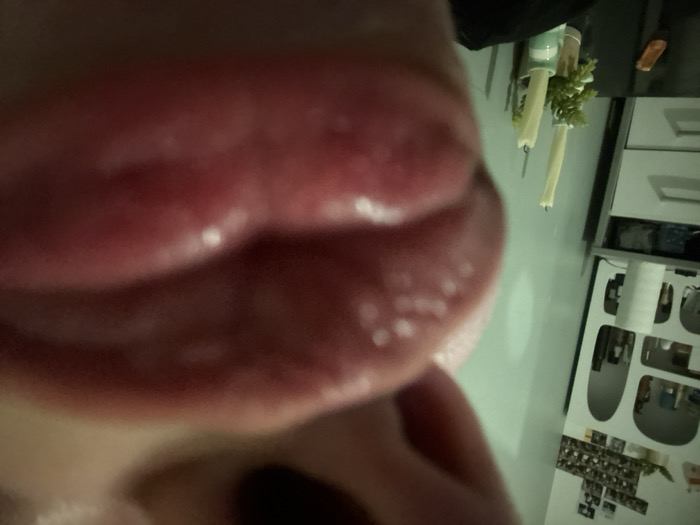 A close-up perspective focuses on a person's lips, displaying minor white spots. The background features a corner of a room, with a table showing candles, a plant, and various items. A white storage unit sits against the wall, covered with photos. The image's orientation is tilted or rotated, altering the usual viewing angle.