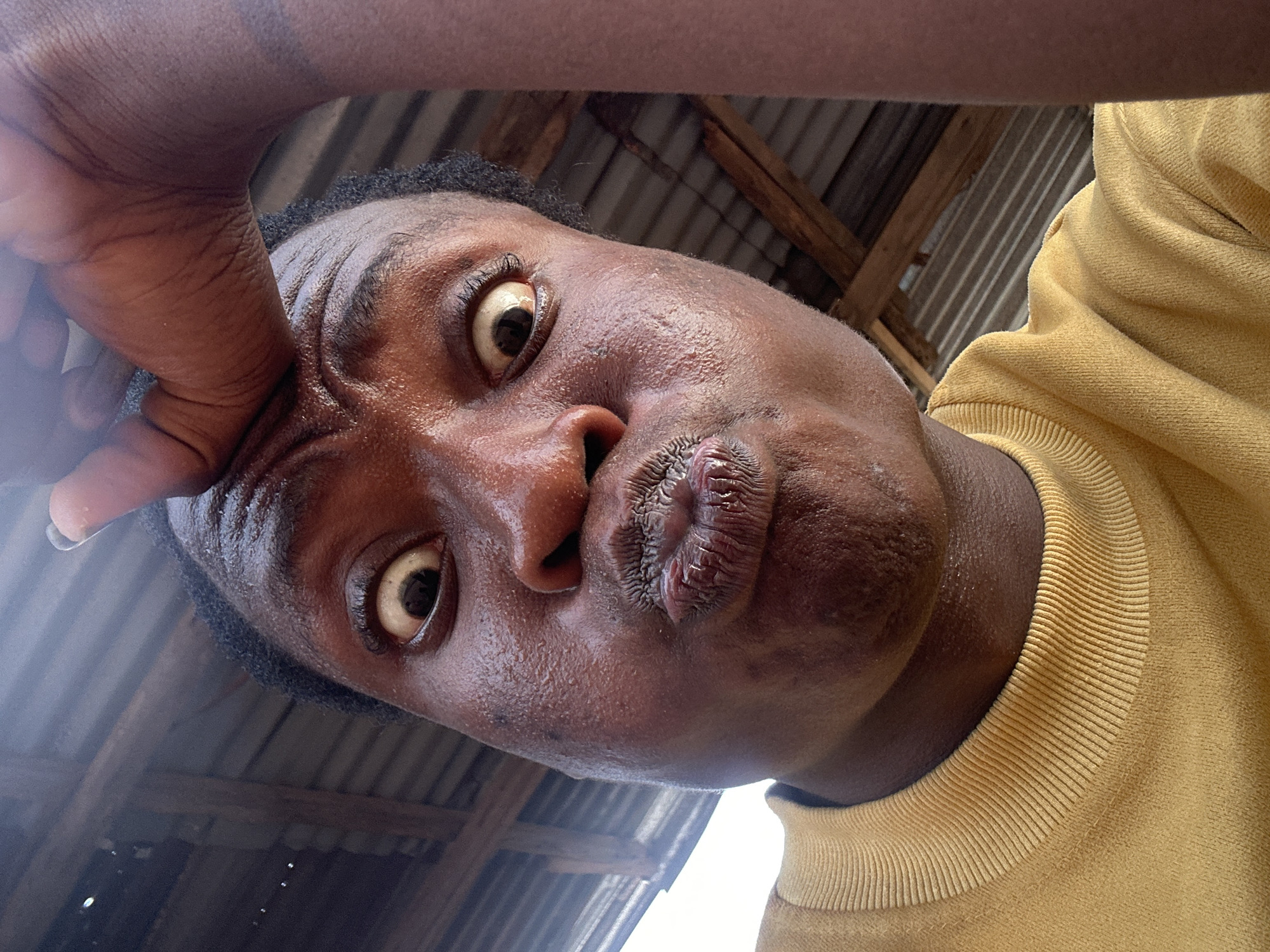 A close-up, low-angle shot features a person with dark skin making a humorous or exaggerated facial expression. The person, likely male, has wide, round eyes with a yellowish tint to the sclera and dark irises, looking upwards. Their lips are tightly pursed, creating a small puckered shape. One hand, also with dark skin, is pressed against their forehead/temple area, causing pronounced wrinkles around their right eye. The person's skin appears somewhat shiny, possibly from sweat or oil. They are wearing a yellow long-sleeved shirt or sweatshirt with a visible ribbed collar and cuff. The background reveals a simple, possibly rustic, indoor or covered setting with a corrugated metal roof and visible wooden support beams. No text is visible in the image.