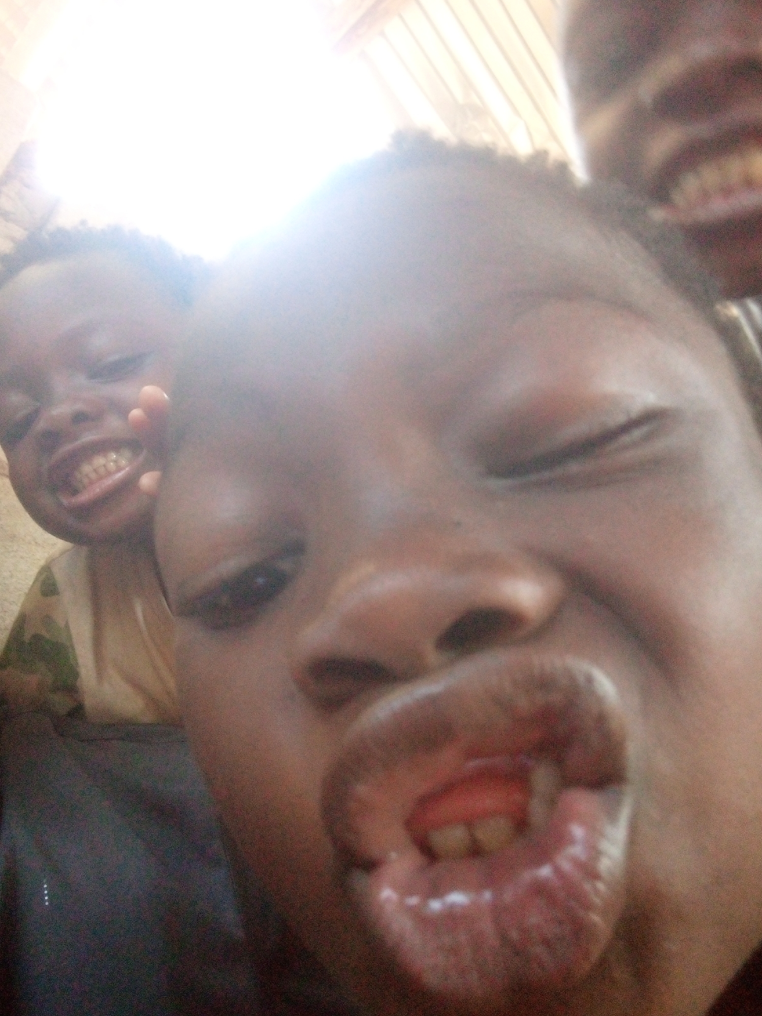 The image shows a close-up of a dark-skinned child making a comical face with pursed lips. The child's right eye is partially closed, and the nose is prominent. Another child is visible in the background to the left, also smiling with teeth showing. A third child's face is partially visible in the upper right corner, displaying teeth. The environment appears to be indoors with bright light coming from above. The location is Unknown, Unknown.
