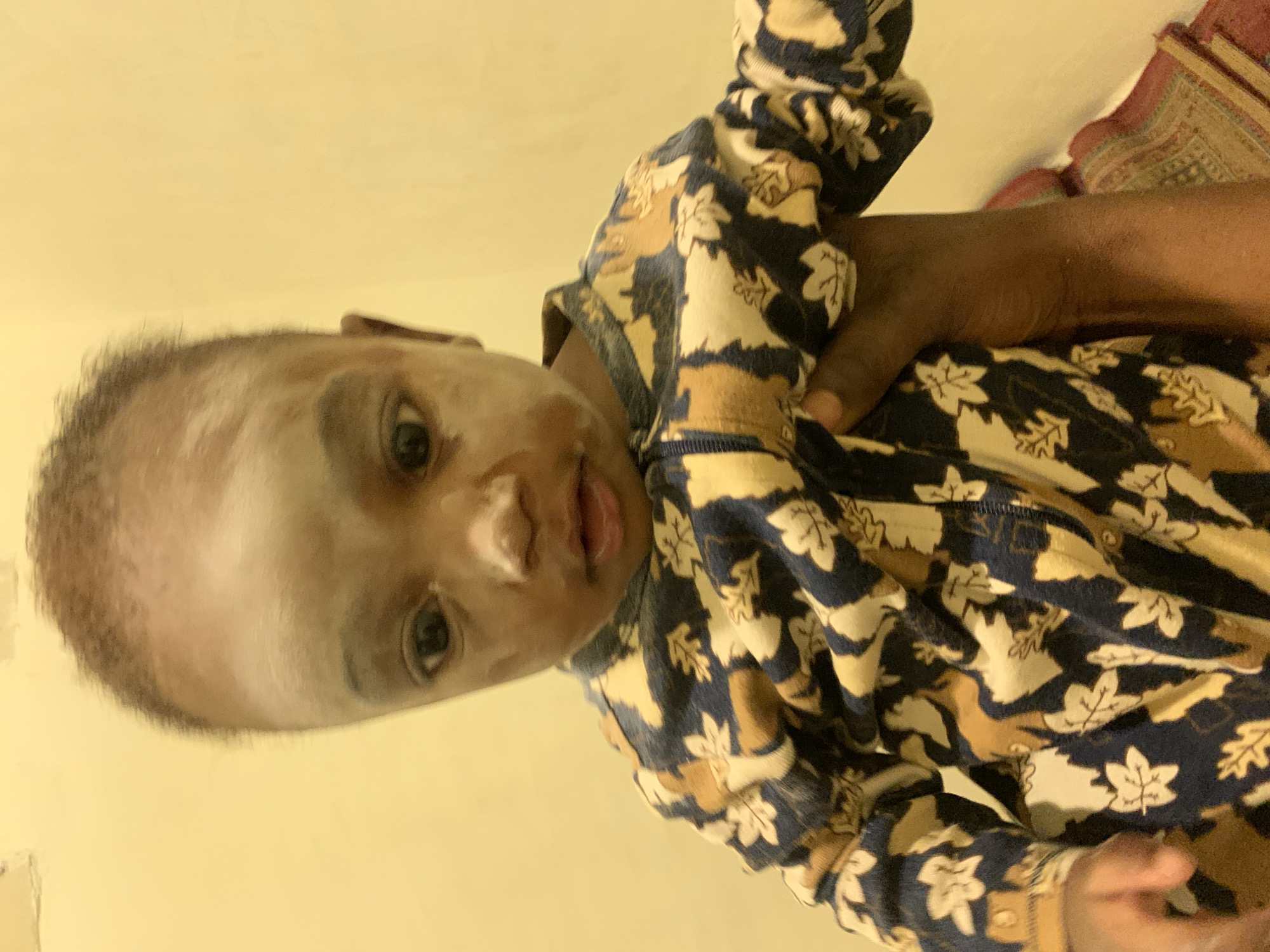 A close-up image captures a young child, likely a baby, being held. The child is wearing a patterned onesie with shades of blue, brown, and cream. The child's face appears ashy. A dark-skinned arm and hand hold the child. The background consists of a plain yellow wall, and a portion of a patterned mat or rug is visible. The image appears to be taken indoors under artificial lighting. There is no contextual information to suggest the location is Jos, Nigeria, and such specifics cannot be deduced from the image.