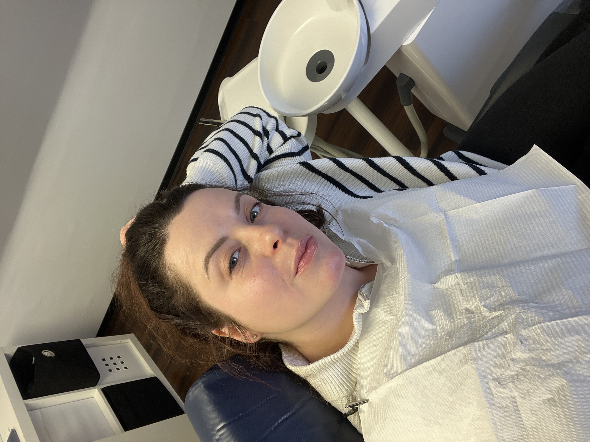 An adult female subject is observed reclining in a blue dental examination chair within a clinical setting in Monsheim, Germany. Her gaze is directed towards the camera. The subject presents with fair skin, light-colored eyes, and reddish-brown hair, partially secured. She is dressed in a light-colored ribbed sweater, beneath a white disposable dental bib fastened by a metal clip at her throat. A white sweater sleeve with black horizontal stripes is visible on her left arm, which is positioned behind her head. A subtle reddish discoloration is apparent on her chin/jawline. Adjacent to the subject's right, a white ceramic dental cuspidor with a dark grey drain is mounted on a white medical apparatus. In the background, to the left, a white modular shelving unit contains dark fabric storage bins. The environment features light-colored walls and dark wooden flooring.