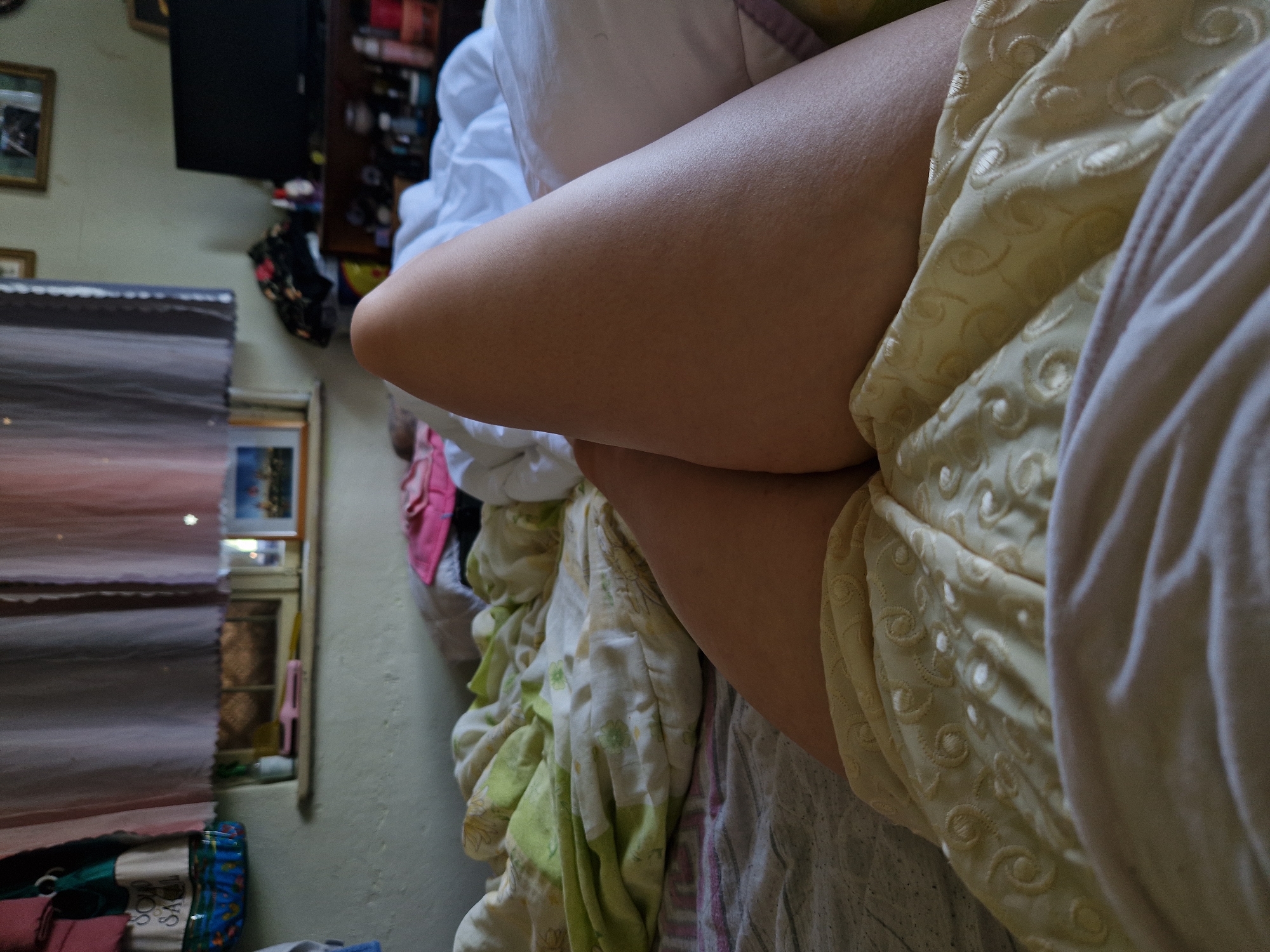 The image depicts a close-up view of a person's legs, resting on a bed. The person is lying on their back, with their legs bent at the knees and crossed at the thighs. They are wearing a yellow garment with a subtle pattern of swirls and circular shapes. The bed is covered with various blankets and sheets, some with floral patterns in green and white, and others in muted grey and white. In the background, a window is visible, adorned with sheer curtains in shades of pink and gray. The windowsill holds a few small objects, and beyond the window, a glimpse of an outdoor scene is suggested. To the right of the window, a television set is visible on a dark wooden shelf unit, along with various items on the shelves. The overall environment appears to be a bedroom, possibly in a residential setting. The location is not specified in the image.