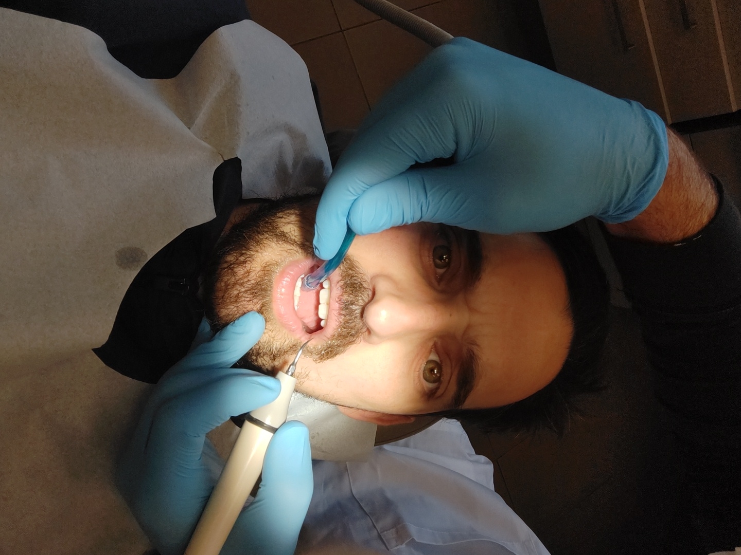 A man with a beard is undergoing a dental cleaning procedure. He is lying in a dental chair covered with a white paper sheet. A dental professional, wearing blue gloves, is using dental instruments inside the man's mouth. The man's eyes are visible, and he appears to be looking at the camera. The background is blurry, but it appears to be inside a dental office. The location of the city of Tel-Aviv, Israel cannot be confirmed based on this image.
