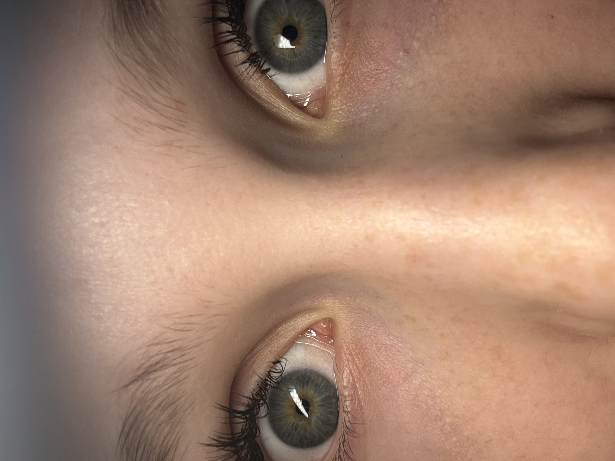 Close-up of two human eyes, one above the other. The eyes have grey irises with gold undertones and black eyelashes. Skin tone is fair. Small amounts of tear film are visible in the inner corners of each eye. The image is tightly cropped. No location information is discernible in the image. The city of Chaikovsky, Russia is irrelevant to the image content.