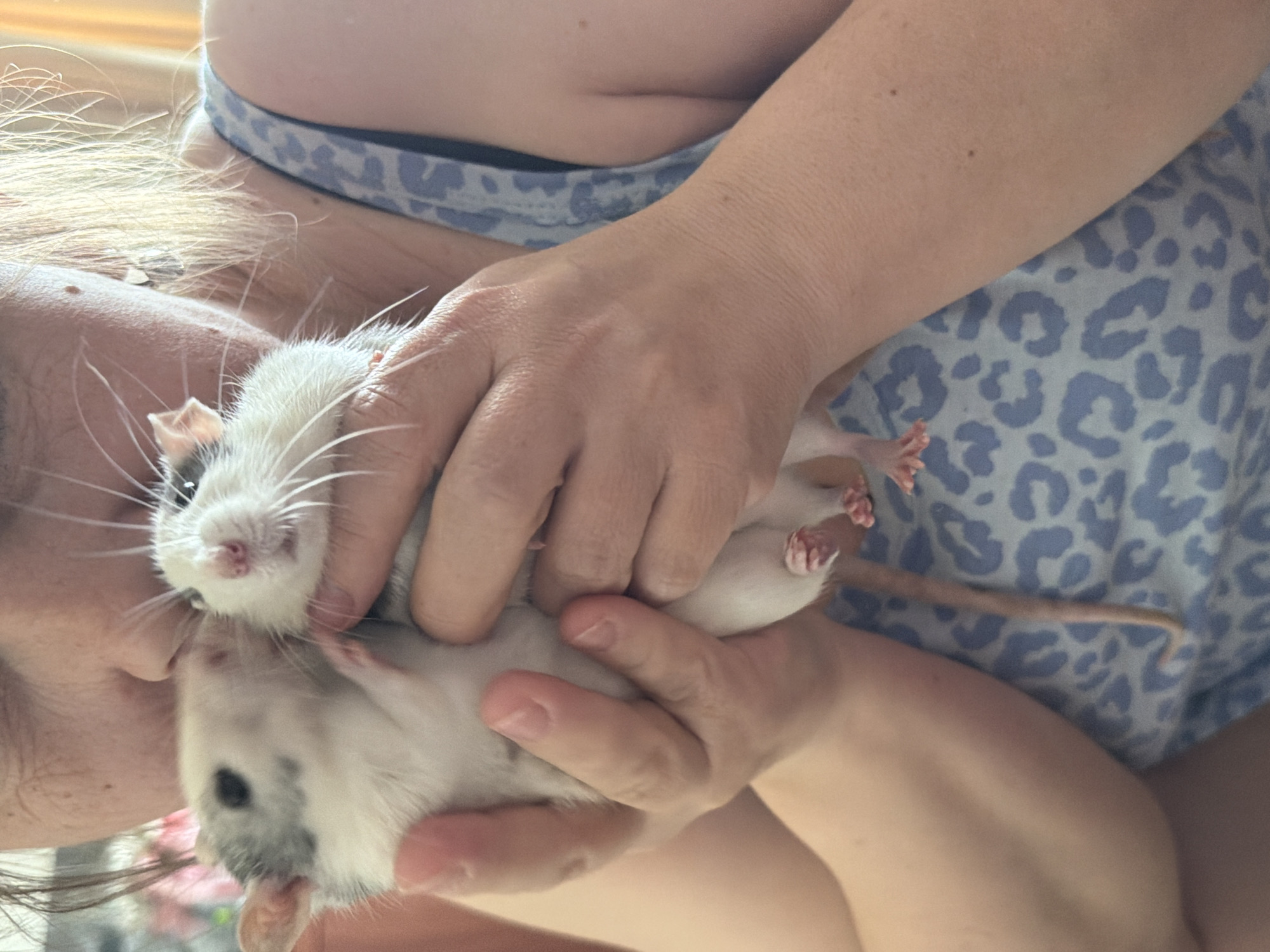 A person with fair skin and blonde hair is holding two rats. The rats are white with gray markings. The person is wearing a light blue and white animal print top. The location is not determinable from the image.