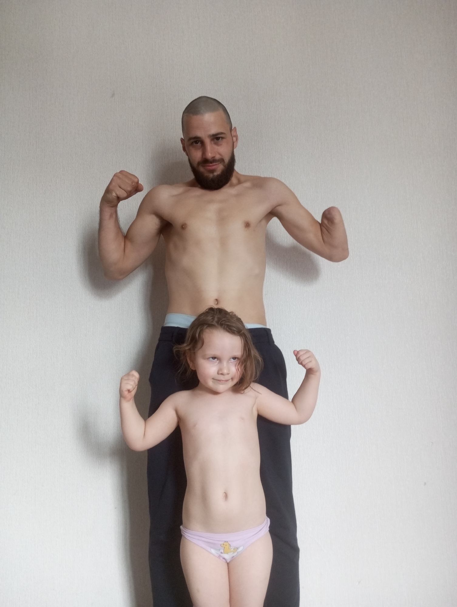 The image depicts two individuals, an adult male and a young child, posing together against a plain, light-colored wall with a textured surface. The adult, positioned behind the child, is shirtless and wearing dark trousers with a light-colored waistband visible. He has a shaved head, a beard, and is flexing his biceps. Notably, his right arm appears to be amputated below the elbow. The child, in front, is also shirtless and wearing light-colored underwear with a pattern. The child is flexing their biceps and smiling. The lighting is even, suggesting an indoor setting. There are no discernible landmarks or environmental features to indicate a specific location within Tbilisi, Georgia.