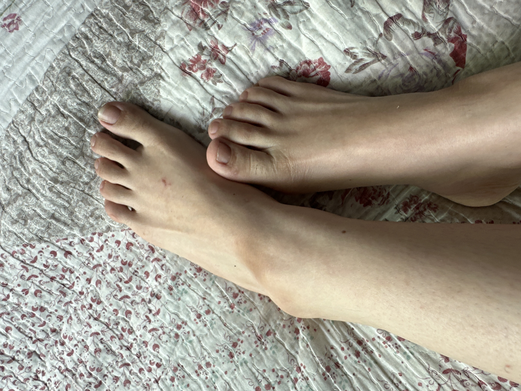 The image shows a close-up view of a person's feet and lower legs resting on a patterned quilt. The quilt has a floral design with pink and green flowers on a white background. The person's skin tone is fair. One foot is positioned slightly above the other, with the toes of both feet visible. There are some small marks or blemishes on the skin. The lighting suggests an indoor environment. The image does not contain any information that allows for the determination of its location in Fergana City, Uzbekistan.