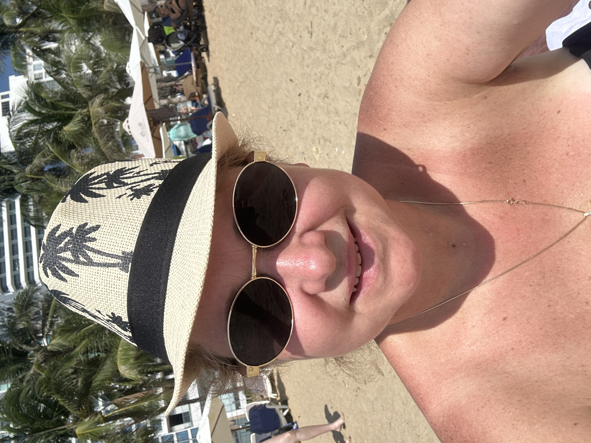 This close-up image, rotated 90 degrees counter-clockwise, features a person relaxing on a sunny beach. The subject is an adult with fair skin, visible freckles, and some sun-induced redness on their shoulders and neck. They are smiling broadly, suggesting a cheerful or relaxed mood, and have light-colored hair visible under their hat.
The person wears a beige straw hat with a black band decorated with black palm tree silhouettes. They are also wearing round, gold-rimmed sunglasses and a thin gold chain necklace.
The scene depicts a sandy beach under bright daylight, indicated by strong shadows and clear visibility. In the background, lush green palm trees dominate the mid-ground, while several white beach umbrellas and beach chairs are visible. Behind these, modern multi-story buildings rise, suggesting a developed coastal area or resort, consistent with a location like Nha Trang Ward, Vietnam. A few indistinct figures of other people can be seen in the distant background. No visible text is present in the image.