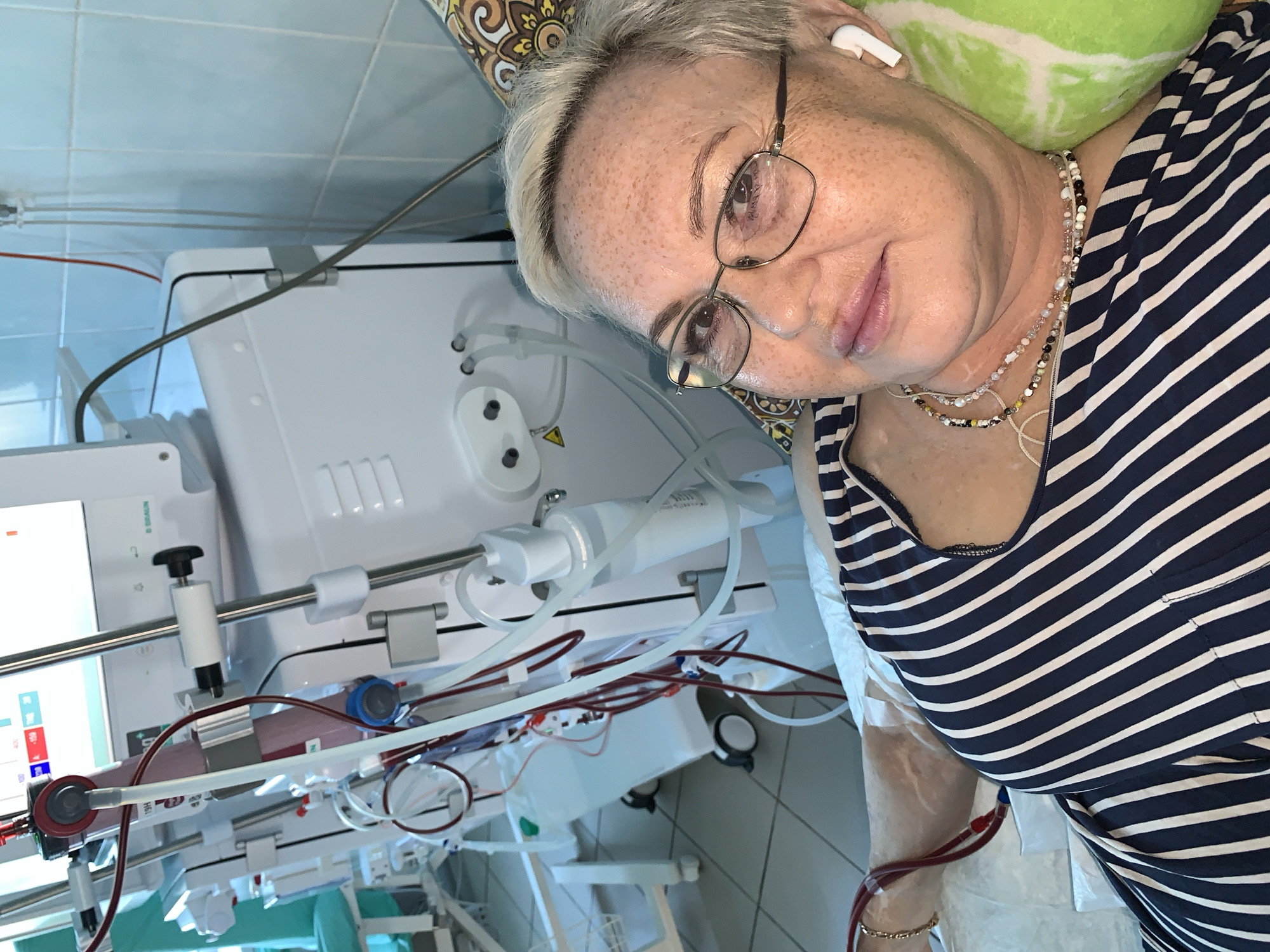 A middle-aged Caucasian woman with short blonde hair, freckles, and glasses is lying in a hospital bed. She is wearing a navy and white striped shirt and has a medical apparatus with tubing connected to her arm. The equipment appears to be a dialysis machine, indicated by the presence of a bloodline, filter, and collection bags. The woman is looking at the camera and has white wireless earbuds in her ears. The room appears to be a medical facility, with tiled walls and other medical equipment visible in the background, suggesting a hospital or clinic setting in Chaikovsky, Russia.