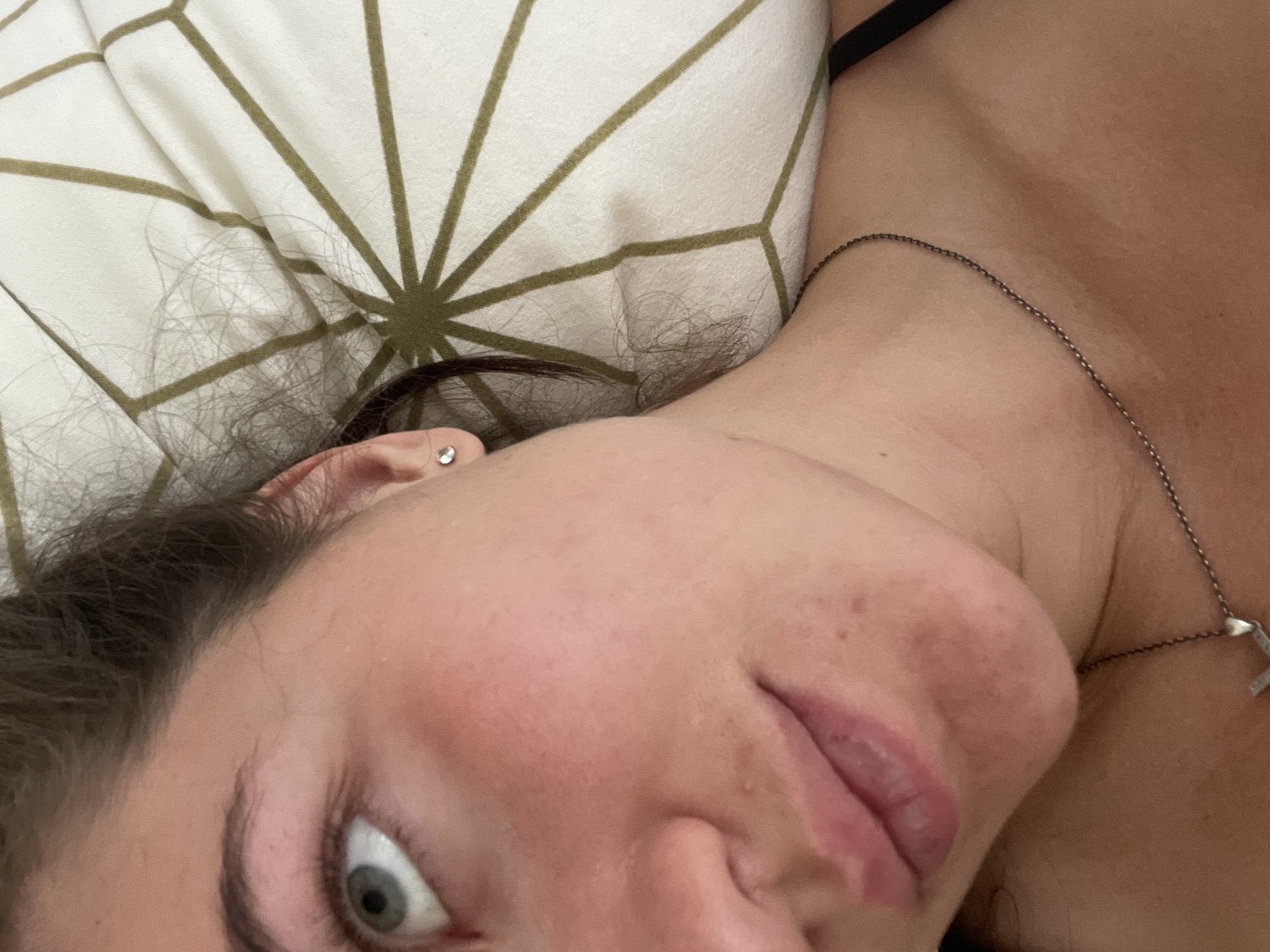 The image shows a close-up of a young woman's face, specifically the left side of her face, including her eye, cheek, and lips, as she lies on a patterned pillow. Her eye is open and looking upwards and to the left. There are small blemishes and redness on her cheek and around her lips. She is wearing a small stud earring in her left ear and a delicate chain necklace. Her dark hair is visible, some strands falling across her face and ear. The pillow she is lying on has a white background with a geometric pattern of green lines forming a starburst design. The environment appears to be indoors, likely a bedroom. There is no discernible indication of the location being in Мосметаллоконструкция Онт, Russia.