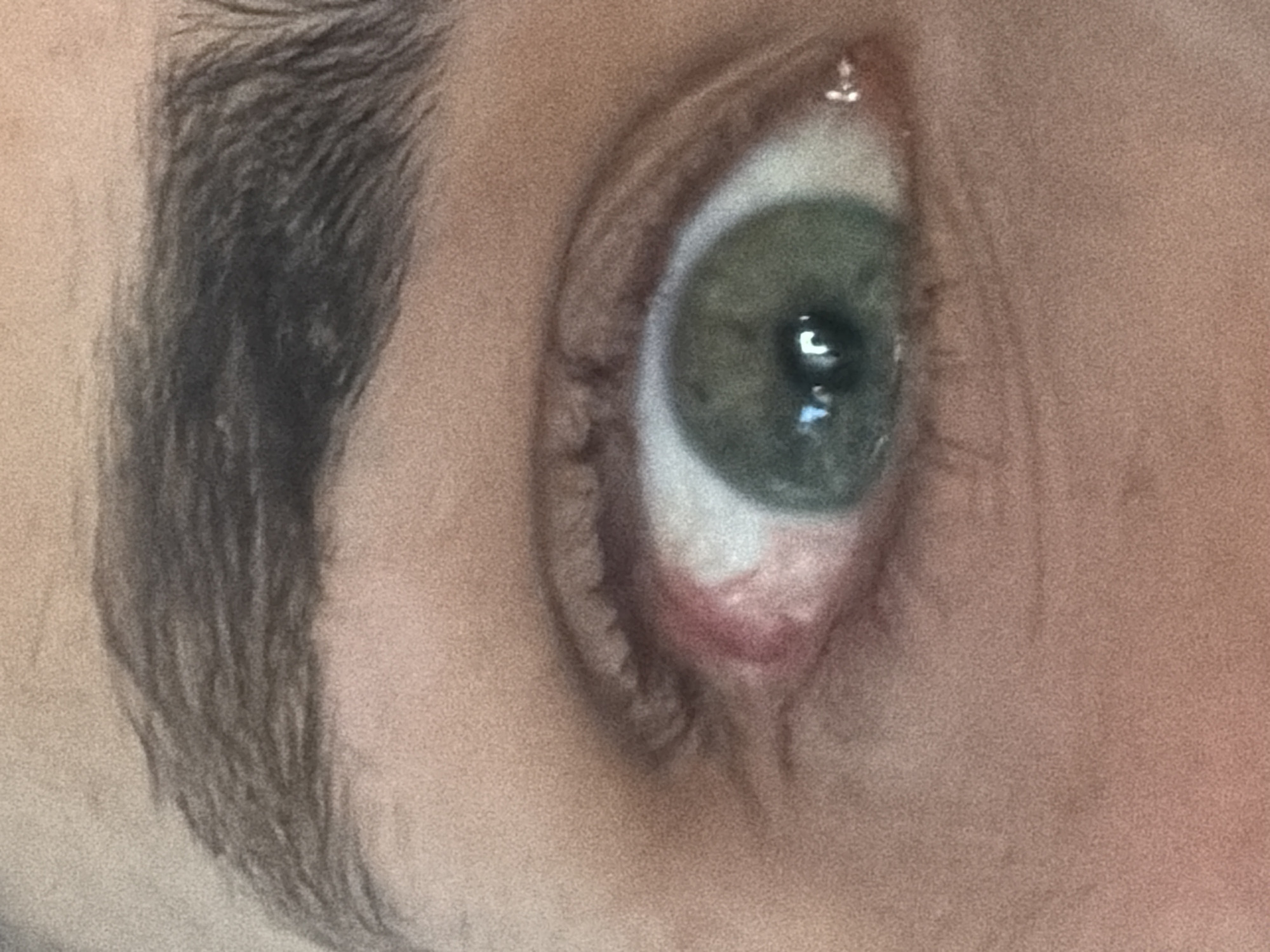 A close-up image focuses on a human eye with light green iris. A distinct eyebrow with dark-colored hair is on the upper left corner of the image. The lower eyelid is pink, with visible blood vessels. Reflective highlights are present in the iris, indicating a light source. No information is present to indicate the city of Ruse, Bulgaria.