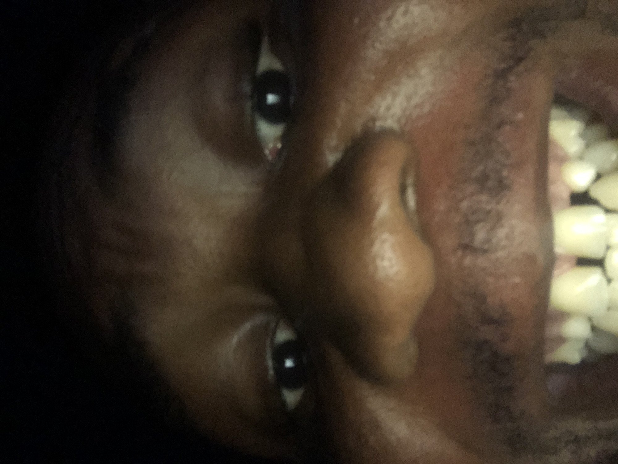 The image depicts a close-up of a person's face, rotated counter-clockwise. Visible features include two eyes, a nose, and teeth. The person's skin tone is dark. No information about the city or environment is available.