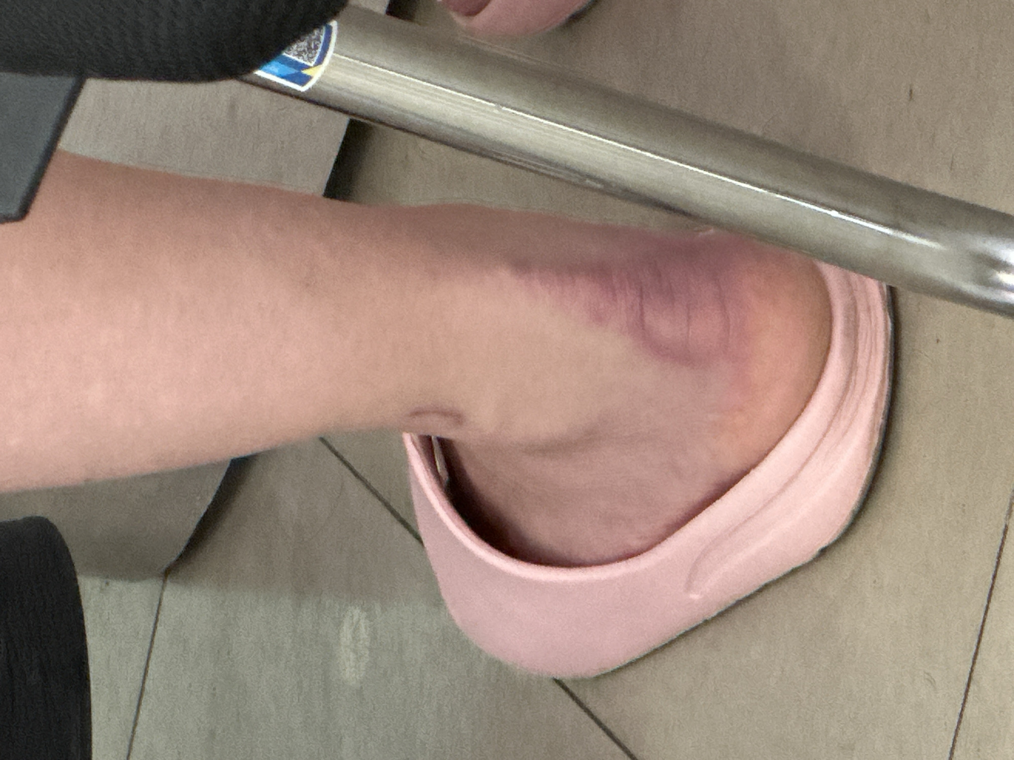 An indoor, close-up shot focuses on a person's lower leg and foot, angled downwards. The foot is partially enclosed in a light pink, casual slipper or backless shoe. A prominent dark purple and reddish bruise is clearly visible on the person's ankle, extending towards the heel, suggesting a recent injury or impact. The foot rests on a light-colored floor, which appears to be tiled or concrete, with faint lines visible.
In the background, a metallic cylindrical bar, likely part of a chair or table leg, crosses the frame diagonally. A small, indistinct sticker, possibly containing a QR code, with blue and white elements, is attached to this bar. A dark, textured fabric or object is partially visible in the upper left corner. The image depicts a moment of repose, likely indoors, with the context provided as Nha Trang Ward, Vietnam. No specific time of day is evident from the lighting, and no legible text can be discerned on the sticker or elsewhere.