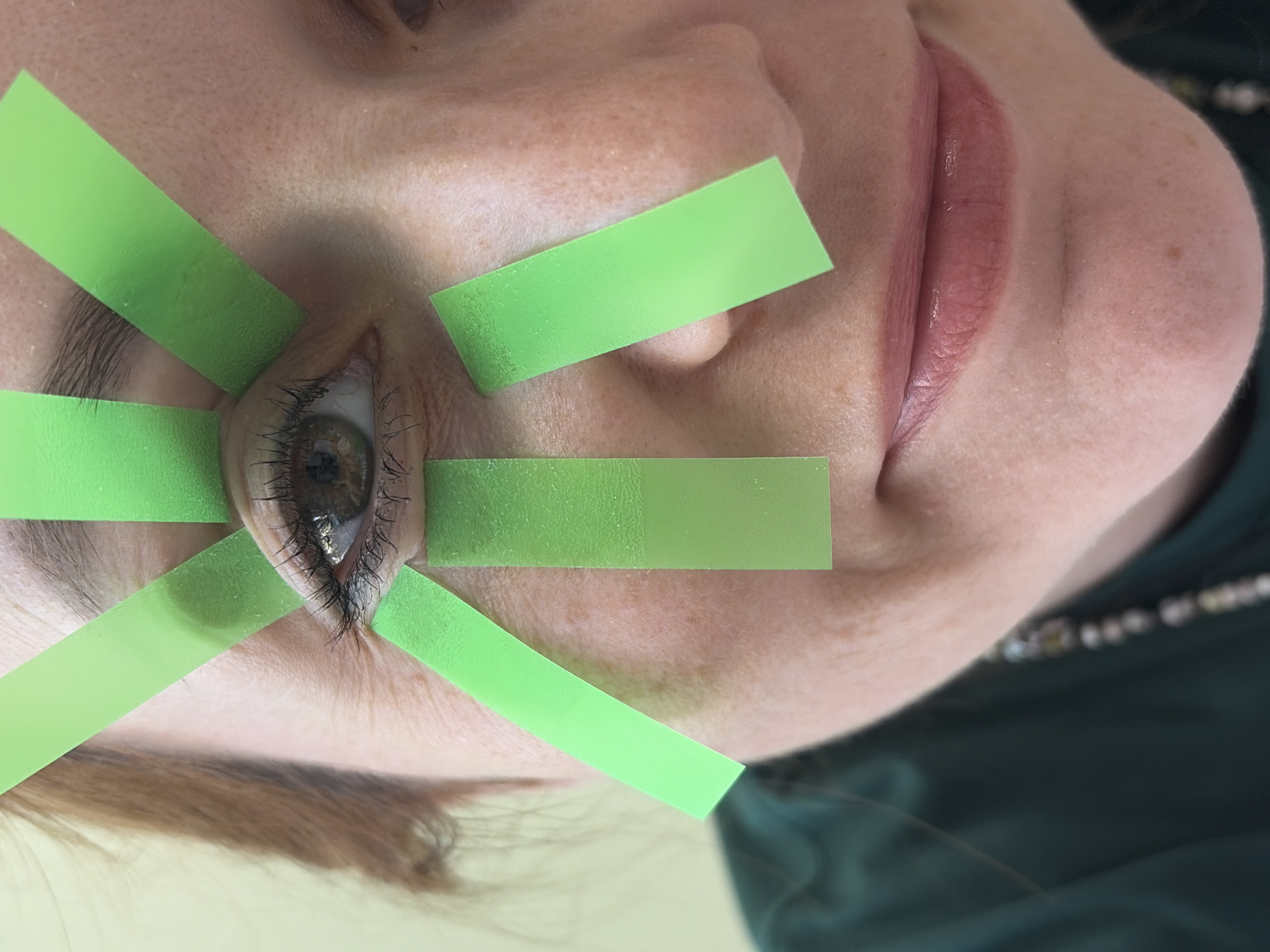 A close-up, angled view of a person's face with light skin, freckles, and brown hair. A single eye is visible, with brown irises and dark eyelashes. Several green rectangular pieces of tape are radiating outwards from the eye. The person's lips are pink and slightly parted. The person is wearing a dark green shirt and a necklace with small beads. There is no information available about the location being the city of Chaikovsky, Russia.