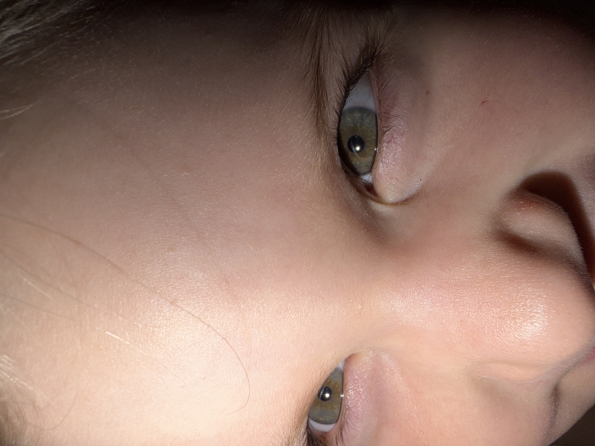 A close-up, rotated image shows a portion of a child's face. Visible features include the child's skin, nose, and two eyes. The eyes are hazel in color, with visible eyelashes and eyebrows. The child's skin appears light-toned, and the image suggests that a bright light is shining on the child's face. There are no other discernible people, objects, or indications of location visible in the image, so the location in Chaikovsky, Russia, is unknown.