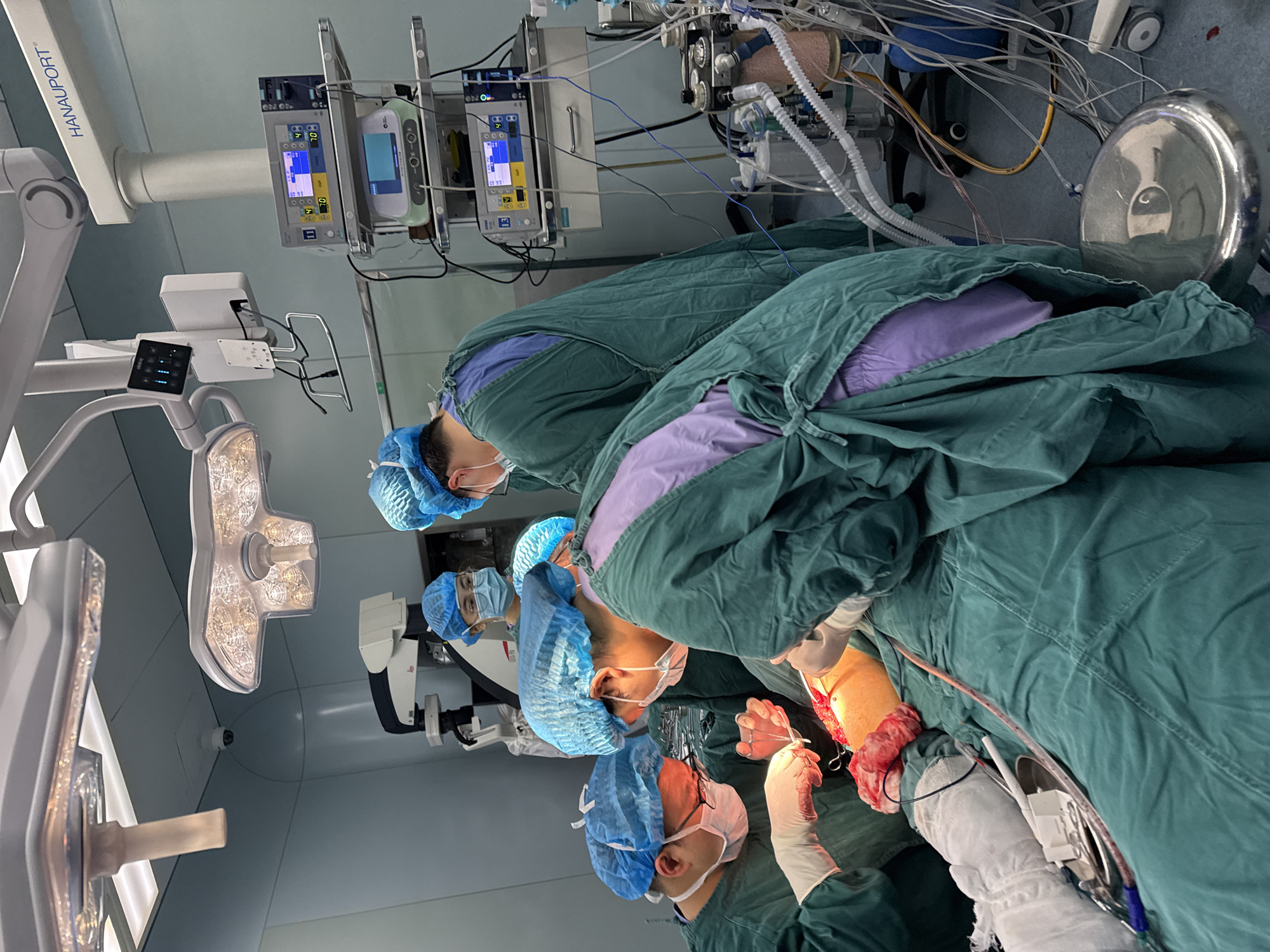 The image depicts a surgical operation in progress, possibly in a hospital setting within the Yuzhong District, China, based on visual cues such as surgical equipment and personnel attire. Several individuals wearing surgical gowns, caps, masks, and gloves are actively involved in the procedure. Medical equipment, including monitors displaying various readings, is visible in the background. The surgical field is draped, and various medical instruments are in use. The environment appears to be a sterile operating room with surgical lights illuminating the area.