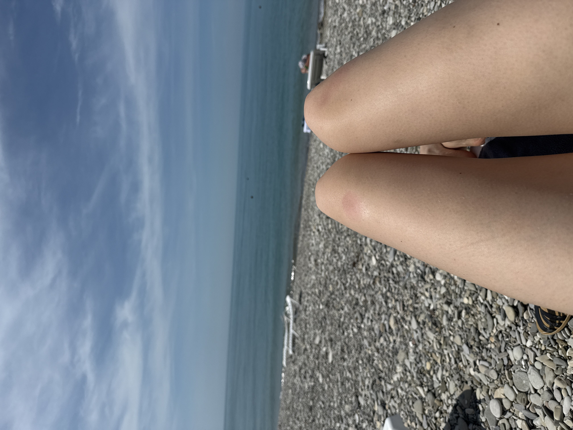 The image depicts a first-person perspective of a beach scene in Nebug, Russia, viewed from a reclining position. In the immediate foreground, the bare legs of an individual are prominent, extending from the bottom edge towards the center of the frame. The skin tone is fair to medium, with visible fine hair and pores. The left knee exhibits a distinct, circular reddish mark, approximately 2-3 cm in diameter, while the right knee has a smaller, less defined reddish area. A small dark mole is visible on the inner aspect of the right thigh and another on the lower left leg. Between the upper thighs, a glimpse of dark fabric (possibly swimwear or shorts) is visible. A portion of a dark-strapped sandal or flip-flop is visible at the bottom left corner, indicating the presence of footwear.
Beyond the legs, a shingle beach extends towards the water's edge. The beach is composed of numerous small to medium-sized grey, white, and brown pebbles. Several white or light-colored beach loungers are scattered across the pebble beach, with at least two clearly visible near the waterline. On the far right, a person is partially visible reclining on one of these loungers, their form indistinct.
The sea, a tranquil expanse of teal-blue water, occupies the middle ground. Small, gentle waves are visible breaking on the pebble shore, creating a line of wet, darker pebbles. The water's surface exhibits some specular highlights from the sunlight. In the mid-distance of the sea, two small, dark, indistinct objects, possibly buoys or distant boats, are discernible.
The horizon line, where the sea meets the sky, is clear and distinct. The sky above is light blue, transitioning to a deeper blue towards the top of the frame. Scattered, wispy white clouds are present, some appearing as elongated streaks, others as diffuse patches, suggesting fair weather. The overall lighting indicates a bright, sunny day.