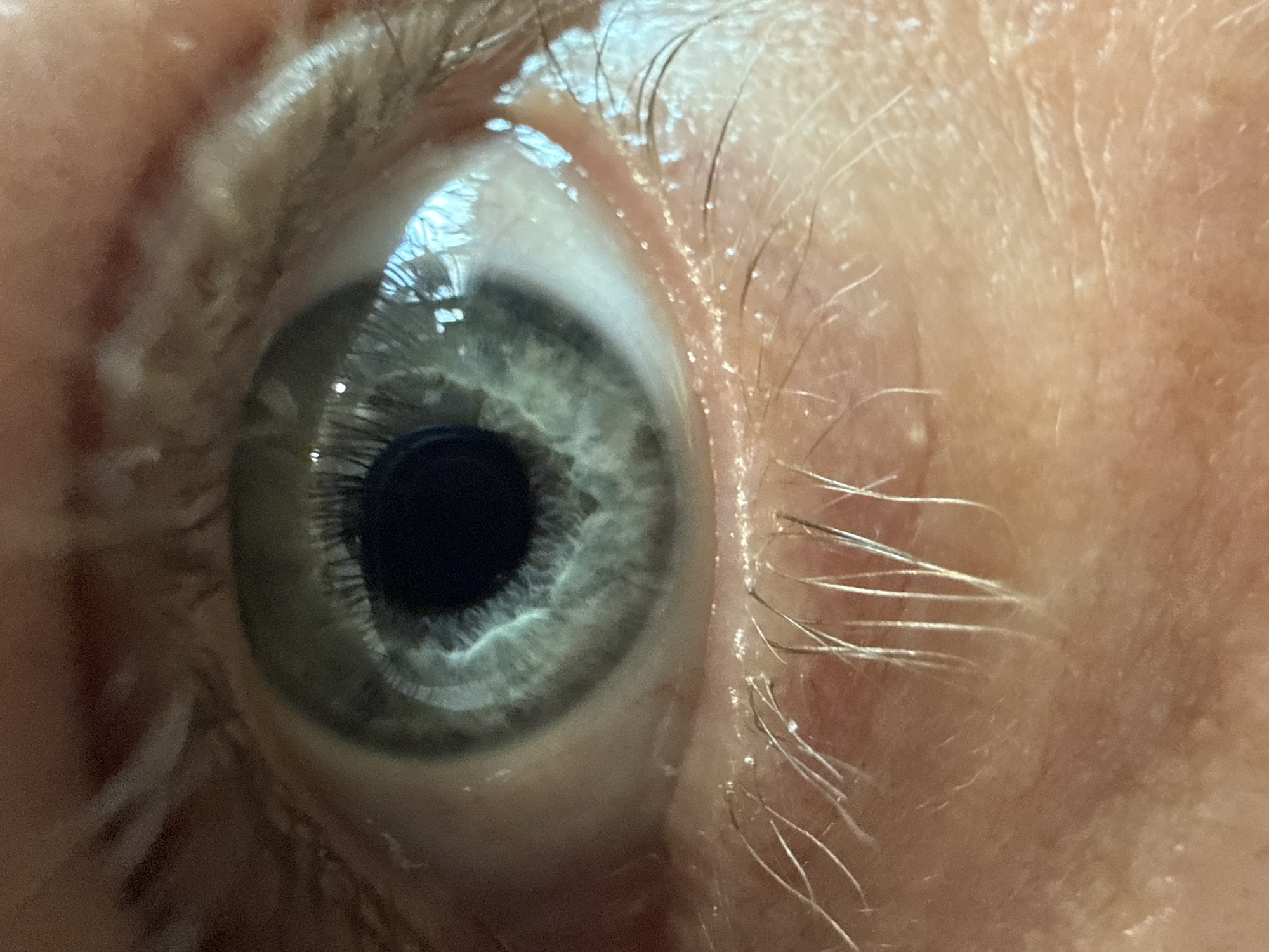 A close-up photograph depicts a human eye with a gray-blue iris and a black pupil. The surrounding skin shows fine wrinkles and sparse eyelashes. The eye appears moist and slightly glossy. The image contains no information to suggest its location in Izhevsk, Russia, or any other specific location. There are no people, actions, or interactions visible beyond the detail of the eye itself.