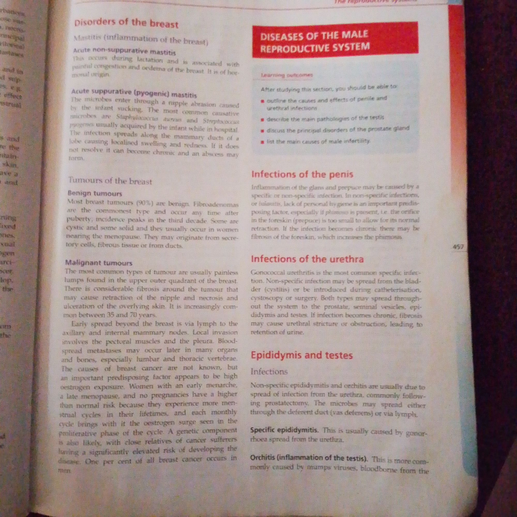The image is a close-up of a page from a textbook, displaying medical information about reproductive health. The text is predominantly in English, with headings such as "Disorders of the breast," "Tumours of the breast," "Infections of the penis," "Infections of the urethra," and "Epididymis and testes." The page includes bullet points under "Learning outcomes" for a section titled "DISEASES OF THE MALE REPRODUCTIVE SYSTEM." There are no discernible elements in the image that suggest a location within Jalingo, Nigeria, nor any other specific city. The content is purely academic and does not depict a real-world scene with people, actions, or a specific environment.