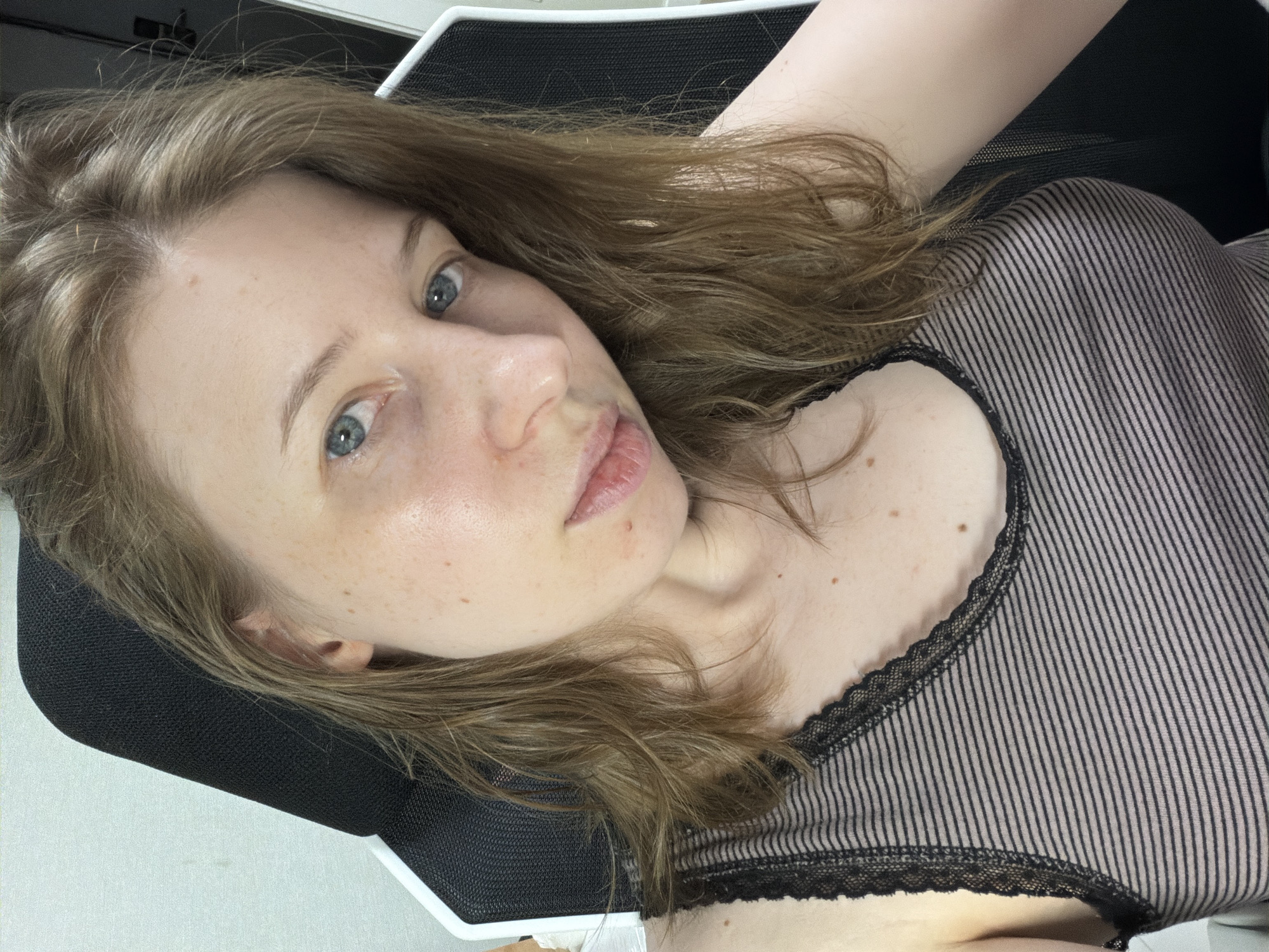 The image shows a close-up selfie of a young Caucasian woman with light brown hair and blue eyes, seated in what appears to be a gaming chair. She is wearing a striped tank top with black lace trim. Her skin has freckles and some blemishes. The background is a plain, light-colored wall. The location is not specified in the image and cannot be determined from the visual information provided. The woman is looking directly at the camera with a neutral expression.