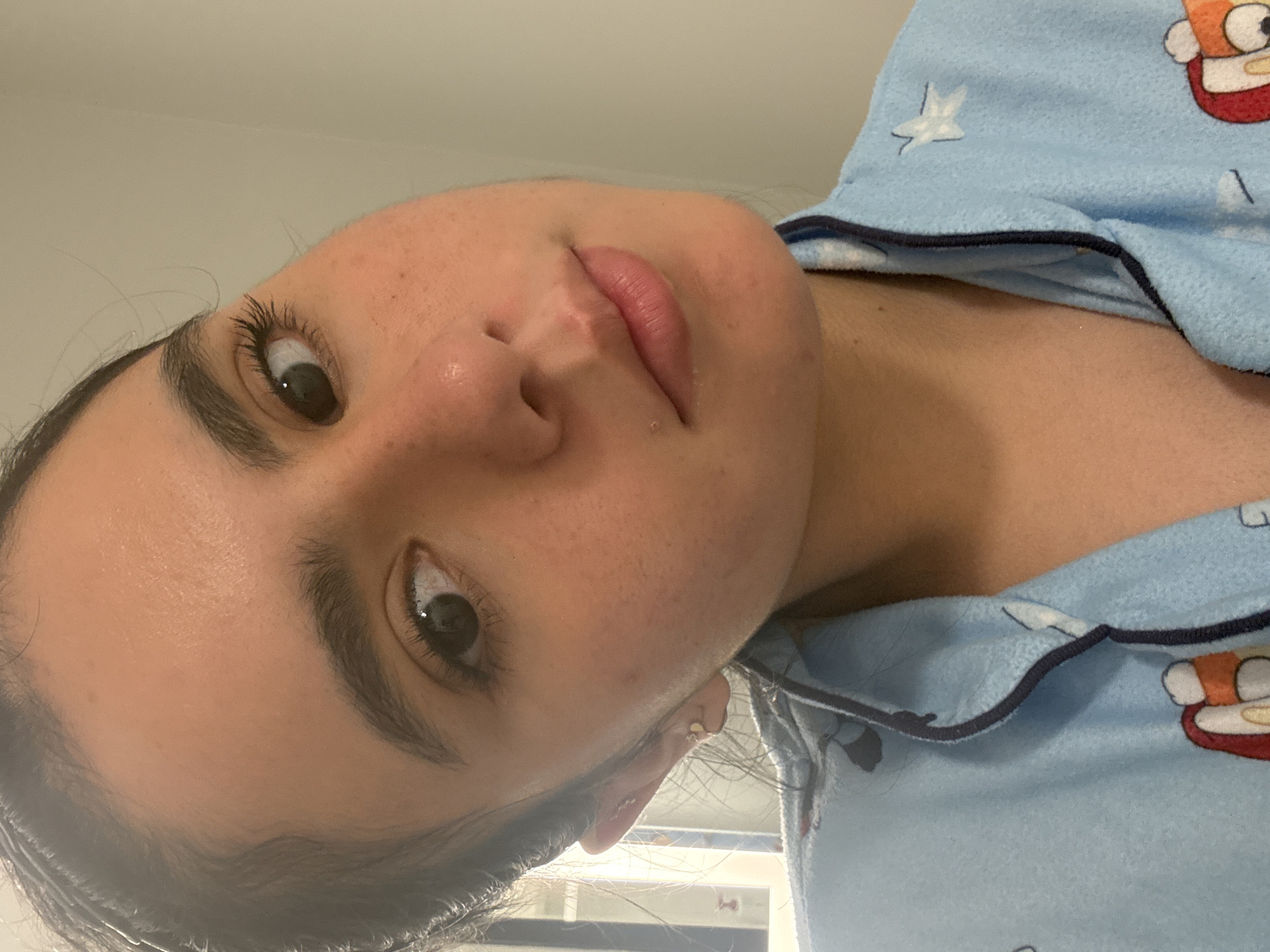 This is a close-up, waist-up, indoor photograph of a young woman. She is facing the camera at a slight angle, with her head tilted. She has dark hair pulled back, prominent eyebrows, and dark eyes. Her skin appears to have freckles and some blemishes. She is wearing a light blue pajama top with a dark blue trim and a cartoon print. The background is out of focus, appearing to be a wall with some lighting. There are no specific landmarks to indicate a location in Austin, Texas.