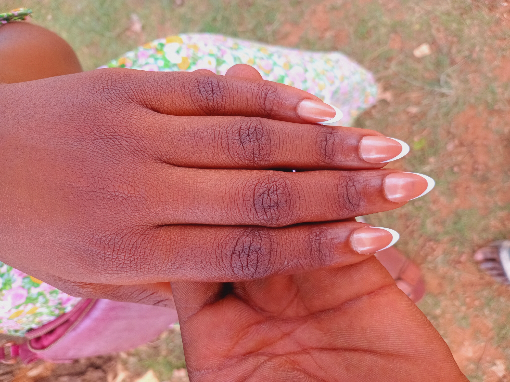 A close-up shot shows two dark-skinned hands, one slightly darker than the other. The upper hand has manicured nails with a French tip design, featuring a white crescent on a beige nail bed. The lower hand is slightly open and supporting the upper hand. The background includes a floral-patterned dress and a glimpse of ground with scattered vegetation. The image was captured outdoors in daylight in Jos, Nigeria.