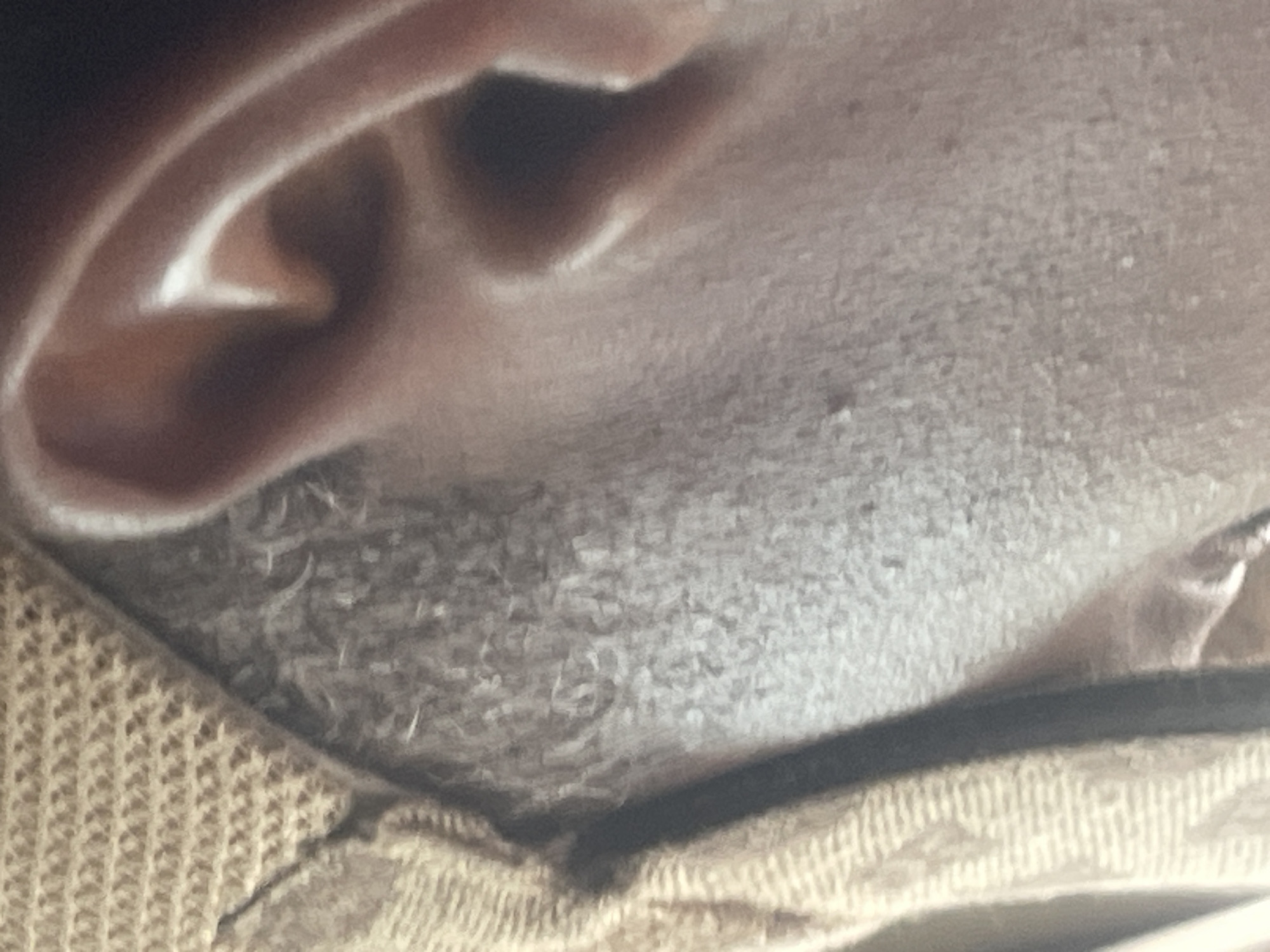 The image is a close-up, side profile of a person's ear and the surrounding skin and clothing. The skin appears to have a light dusting of what could be sand or powder, with small dark pores visible. The ear itself is a reddish-brown hue and is well-defined with light reflecting off its curves. To the left of the ear, a textured, woven fabric in a light brown or beige color is visible, with a darker vertical stripe running down its edge. The overall impression is of a person outdoors in a dusty environment, possibly in Abuja, Nigeria, given the context provided. There are no other individuals or objects clearly identifiable in the frame. The lighting suggests it is daytime, with a strong light source coming from the right, casting a slight shadow within the ear canal.