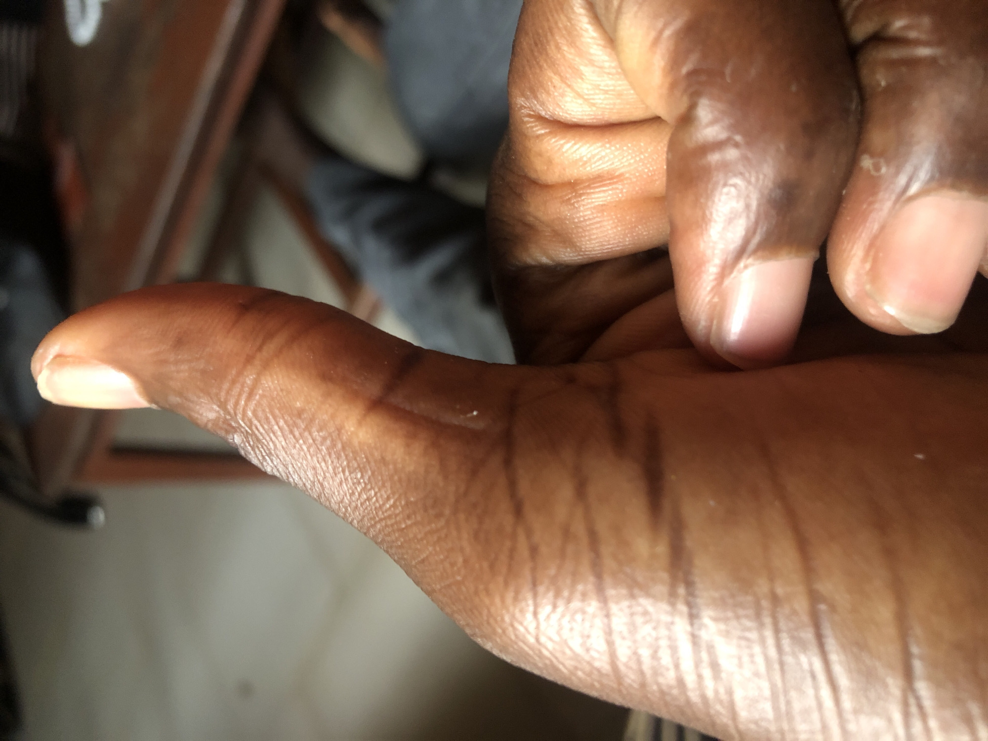 A close-up view of a dark-skinned hand, with the thumb extended and other fingers curled into a fist. Wrinkles and texture of the skin are visible. A leg in gray trousers is partially visible in the background, along with a dark object and a brown wooden surface. Location is Unknown, Unknown.