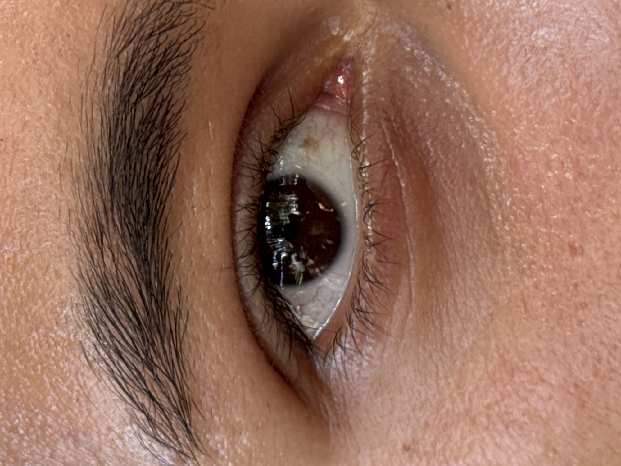 This is a close-up, high-resolution photograph of a human eye, likely taken in the city of Nam Nha Trang Ward, Vietnam. The image focuses on the right eye of an individual, showcasing the iris, pupil, sclera, eyelashes, eyebrows, and the surrounding skin. The iris is dark brown and reflects a dimly lit environment. The sclera appears healthy with visible blood vessels. The eyelashes are dark and prominent, framing the eye. The eyebrow above is also dark and well-defined. The skin surrounding the eye exhibits texture and tone, with subtle creases and pores visible. The lighting suggests an indoor or shaded outdoor setting. The overall presentation is a detailed anatomical study of the eye and its immediate features.