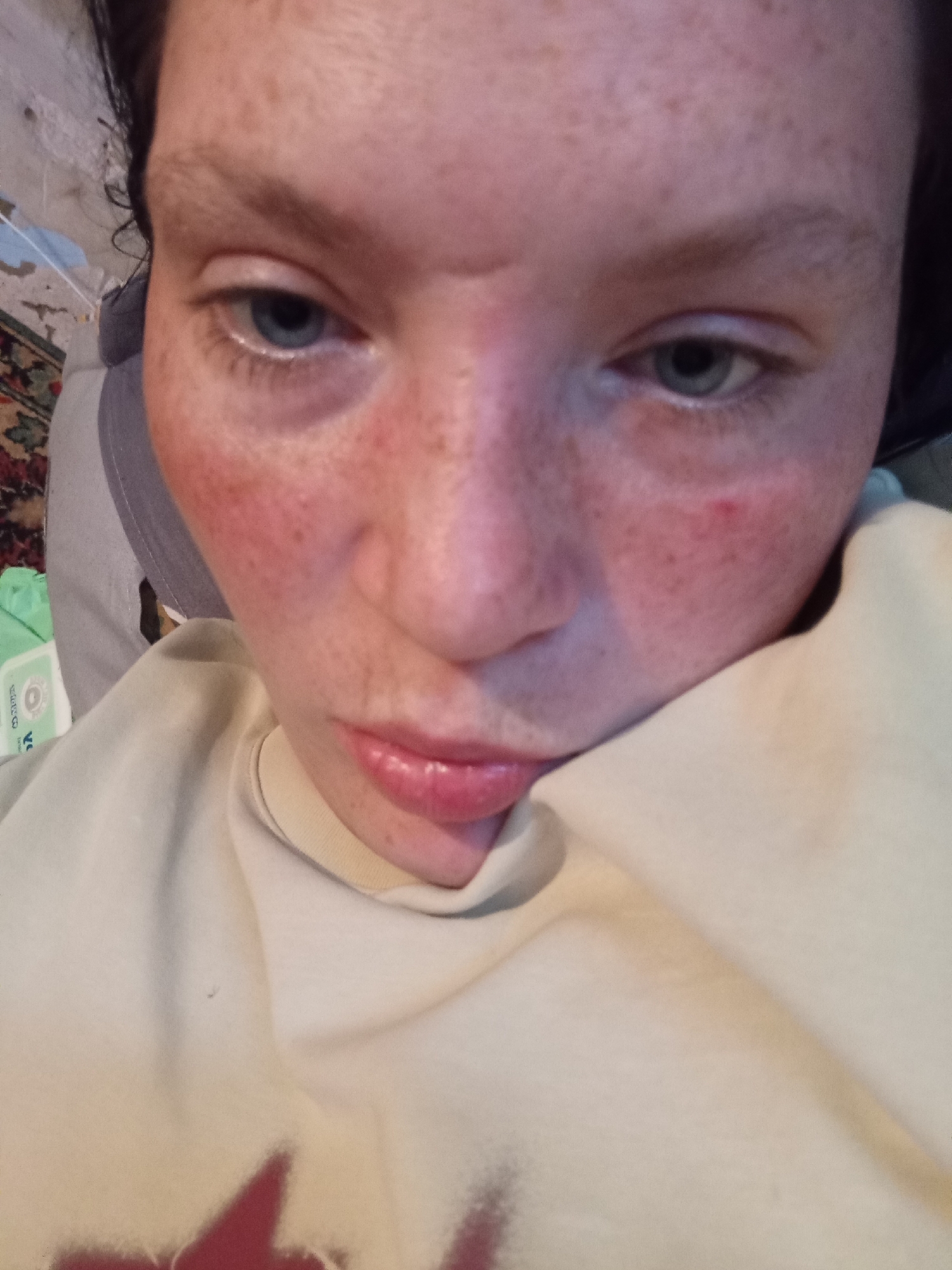 The image is a close-up, slightly distorted selfie of a person's face. The subject has light-colored skin with numerous freckles across their cheeks and forehead. Their eyes are open and looking slightly to the side. Their lips are closed and appear to be slightly plump. The person is wearing a light-colored sweatshirt or shirt that covers their neck and chest. There is a hint of dark hair visible on the right side of the frame.
The setting appears to be indoors, with some background elements suggesting a domestic environment. A patterned rug is partially visible on the left, along with what looks like some laundry or fabric draped over an object. A green package with some writing on it is also visible in the background.
The lighting suggests it is daytime, but the specific time of day or weather conditions cannot be determined from the image. The overall emotion conveyed is neutral or perhaps slightly somber, due to the close-up framing and the subject's gaze.
There is no discernible text in the image that can be clearly read.
The location context is Dalneretschensk, Russia, but there are no specific visual cues within the image that confirm this location.