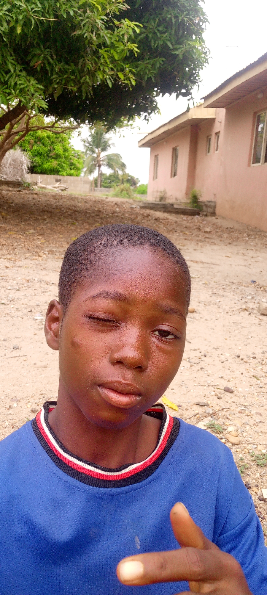 A close-up shot captures a young person with a dark complexion, wearing a blue shirt with a striped neckline (black, white, and red). The individual is squinting with their left eye, and a mark is visible on their left cheek. The background shows a dusty, light brown ground, a light pink building with window openings, and trees with green foliage. The scene appears to be outdoors, with the lighting suggesting it is daytime in Adankolo, Nigeria.