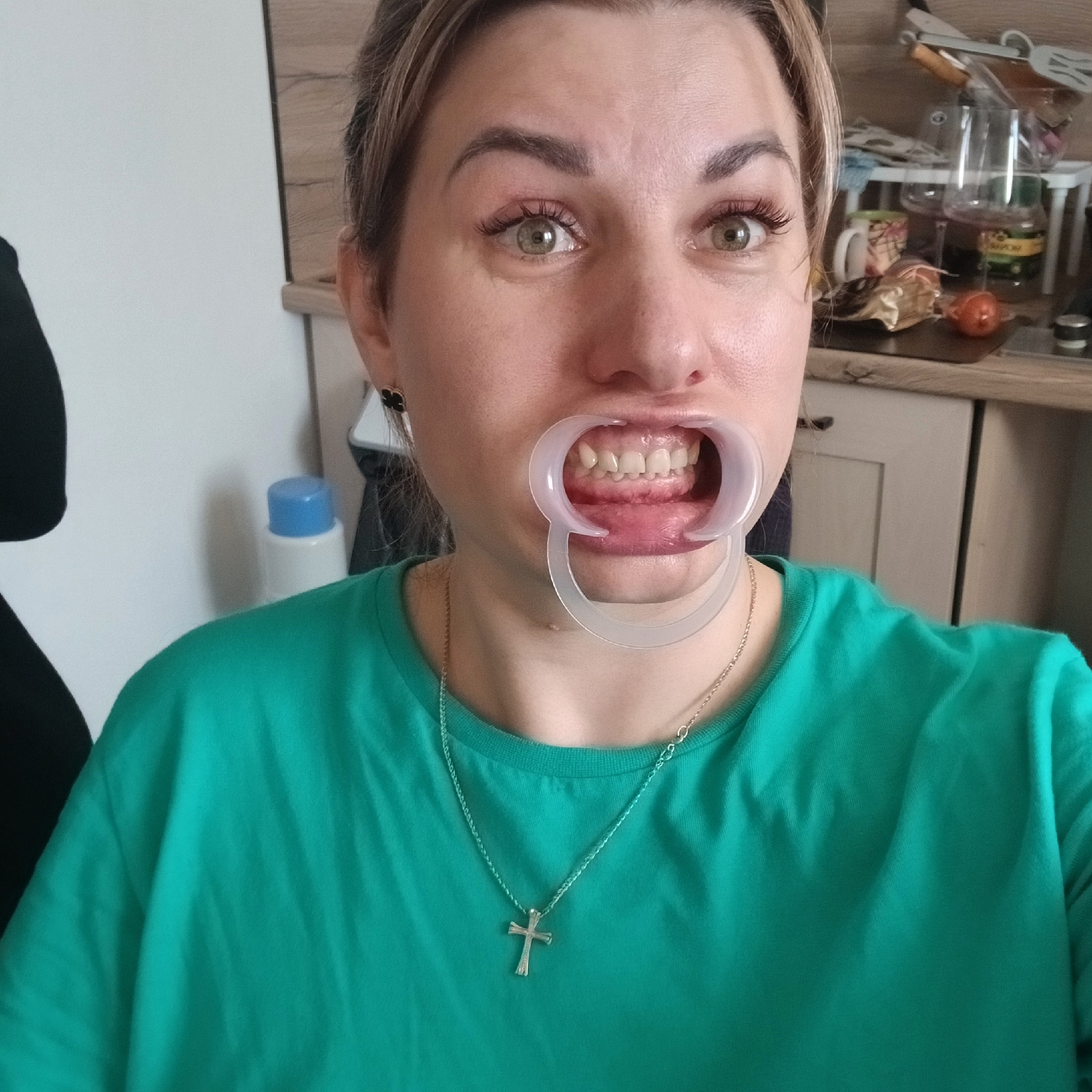 A medium close-up, eye-level shot captures an adult woman indoors, likely within a home in Izhevsk, Russia. She looks directly at the camera, wearing a bright teal or green t-shirt and a silver chain with a cross pendant. Her light-colored hair is pulled back, and she has well-defined eyebrows, long eyelashes, and wide, light green or hazel eyes. She is also wearing black, clover-shaped earrings.
A clear plastic dental retractor is positioned in her mouth, holding her lips and cheeks open to reveal her upper and lower front teeth and gums. Her expression appears neutral and focused.
The background on the left side features a white wall with a partial view of a dark object (possibly clothing) and a white bottle with a blue cap. The right side of the background reveals a wooden cabinet or shelf and a cluttered countertop. Various household items are visible, including several clear glasses, mugs, kitchen utensils, a red onion, and a bottle with a yellow label. Any text on the yellow-labeled bottle is not clearly legible. The lighting suggests it is daytime, and the overall setting points to a domestic environment, possibly a kitchen or utility area. The presence of the dental retractor indicates an activity related to oral examination or personal dental care.