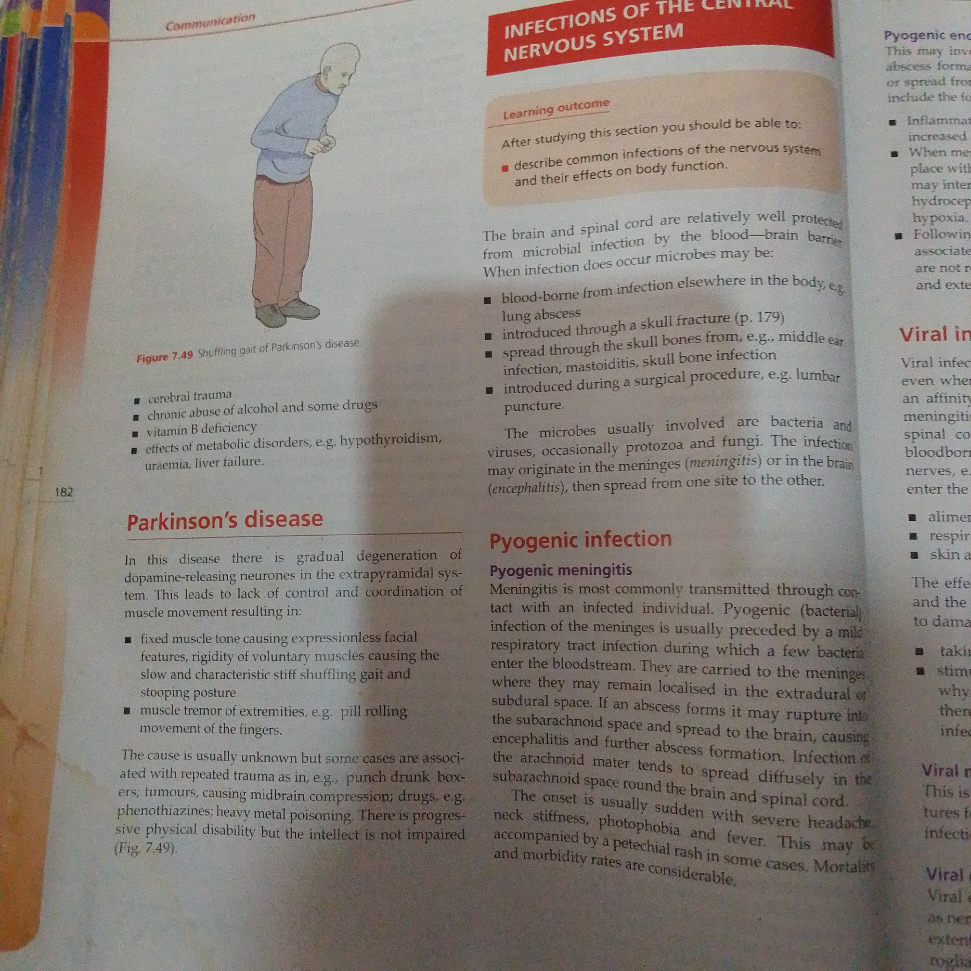 The image is a page from a textbook discussing infections of the central nervous system, with a specific focus on Parkinson's disease and pyogenic infections. The page features an illustration of an elderly man with a stooped posture and shuffled gait, characteristic of Parkinson's disease. He is depicted in profile, facing left, wearing a light blue long-sleeved shirt and brownish-red trousers. His hands are held near his chest, and his body is slightly hunched forward.
The text on the page is divided into several sections. A prominent red banner at the top reads "INFECTIONS OF THE CENTRAL NERVOUS SYSTEM." Below this, a "Learning outcome" section outlines what a student should be able to do after studying the material. The main content discusses how the brain and spinal cord are protected, potential routes of infection (blood-borne, skull fractures, middle ear infections, surgical procedures), and the types of microbes involved (bacteria, viruses, protozoa, fungi).
A specific section titled "Parkinson's disease" describes the degeneration of dopamine-releasing neurons, leading to symptoms like fixed muscle tone, expressionless facial features, rigidity, and shuffling gait. It also lists potential causes such as trauma, tumors, drugs, and heavy metal poisoning.
Another section focuses on "Pyogenic infection," detailing "Pyogenic meningitis." It explains how this bacterial infection is transmitted, its progression, and its typical onset symptoms, including severe headache, neck stiffness, photophobia, and fever.
On the right side of the page, sections on "Viral infection" and "Viral meningitis" are partially visible. There is also a small number "182" on the left margin, likely a page number. The text uses bullet points to present information clearly. The overall setting is an educational environment, with the page laid out for study. There are no indications of time of day, weather, or specific emotions displayed by the subjects, other than the clinical description of Parkinson's disease symptoms. The location context provided ("Jalingo, Nigeria") does not appear to be directly represented in the visual content of the page itself, which is a generic educational illustration and text.