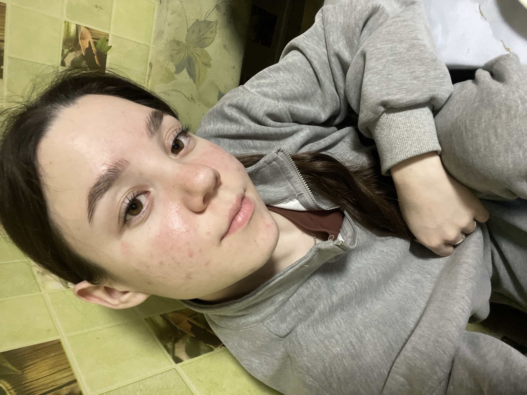 A young female with long, dark brown hair and brown eyes is depicted in a close-up, indoor portrait within the city of Ольховка, Russia. Her skin exhibits redness and multiple small blemishes across her cheeks, chin, and forehead. She is wearing a grey, full-zip sweatshirt with a maroon or dark red garment visible underneath. A thin, silver-toned chain necklace is present around her neck, and a silver-toned ring is visible on the ring finger of her left hand, which is resting partially obscured by her sleeve. The subject is looking directly at the camera, with her head slightly tilted. The background consists of two distinct sections: to the viewer's left, a wall tiled with light green, square ceramic tiles, some featuring subtle patterns; to the viewer's right, an upholstered surface, possibly a sofa, covered in a light green fabric with a repeating dark green floral or leaf pattern. The lighting is consistent with an interior setting.