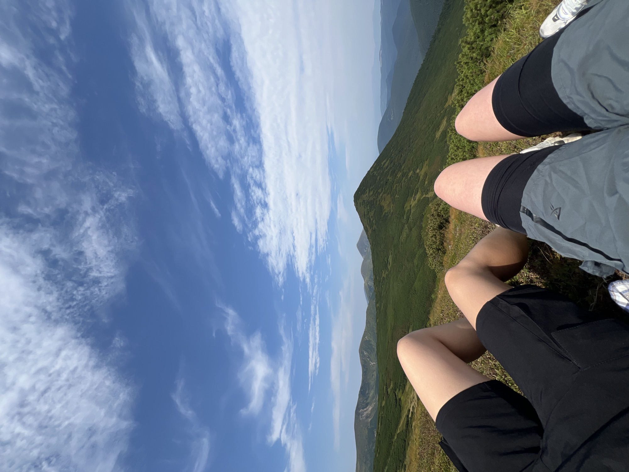 The image shows a first-person perspective of two individuals sitting on a grassy hillside overlooking a mountainous landscape. The foreground is dominated by their legs, clad in black and grey shorts. The background reveals rolling green hills and mountains under a bright blue sky with scattered white clouds. The location is identified as the city of Vorokhta, Ukraine.