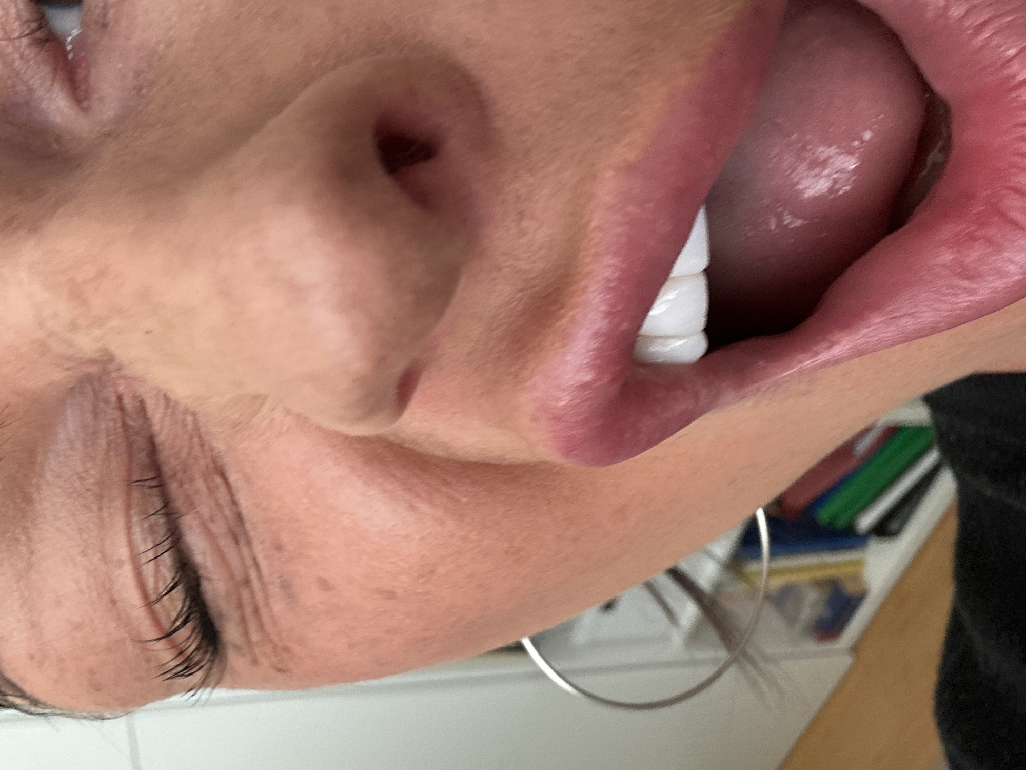 The image shows a close-up, upside-down view of a person's face, focusing on their mouth, nose, and one eye. The person has their mouth open, revealing bright white teeth and a visible tongue. The lips are a deep pink color. The nose is prominent in the frame, positioned to the left of the mouth. One eye is visible at the top left of the image, with dark eyelashes. The person is wearing a hoop earring. The background shows a cluttered white surface with various colorful objects. There is no information to suggest the location of this image is in Wealden, United Kingdom.