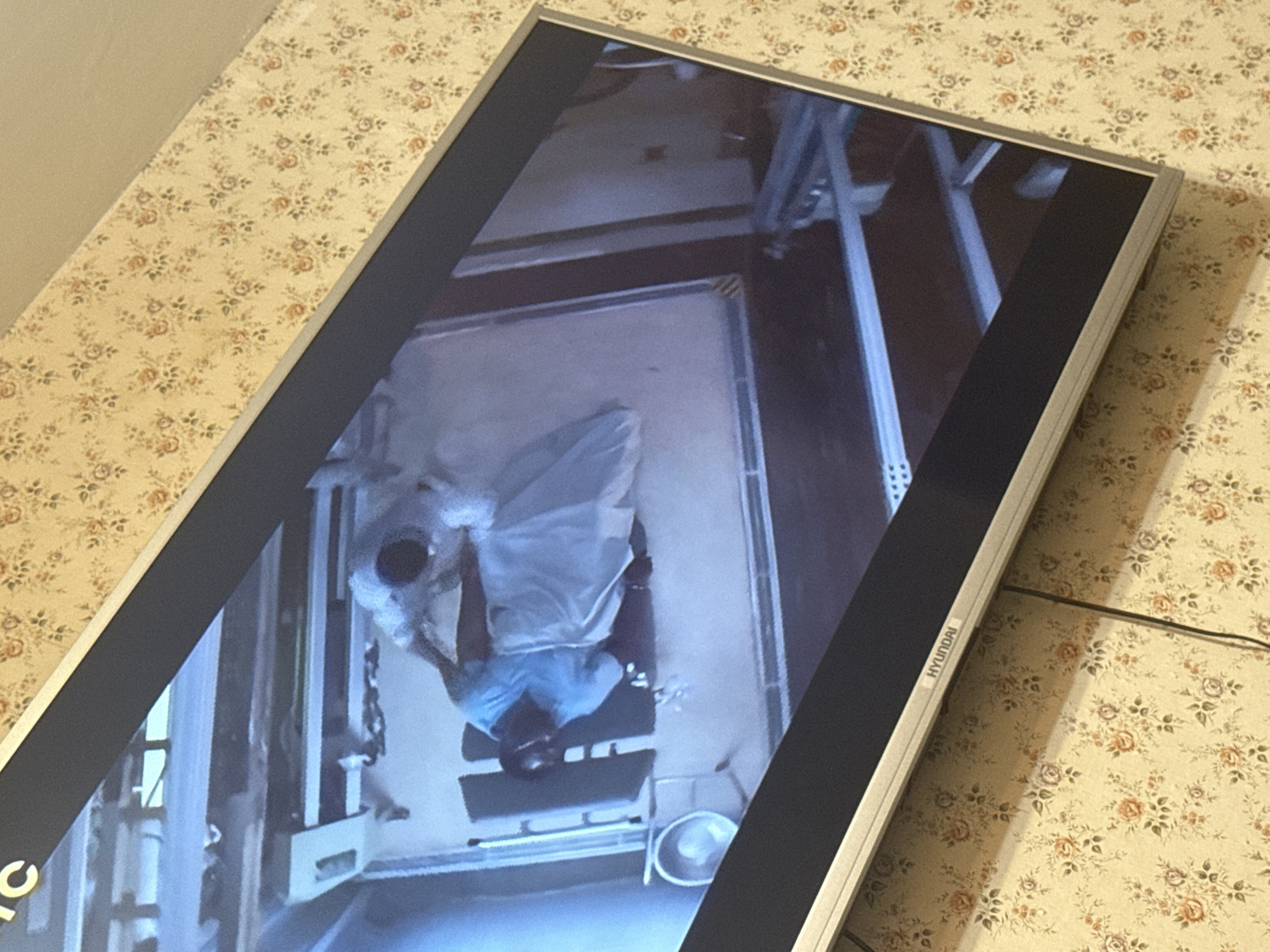 A Hyundai monitor displays a video of a medical procedure, possibly a surgery. The monitor rests on a surface covered with a floral patterned cloth. The video shows an overhead view of a person lying on an operating table, covered by a surgical drape, with medical personnel attending to them. Surgical instruments and equipment, including a bucket, are visible around the operating table. The location in Mytishchi, Russia, cannot be determined from the image.