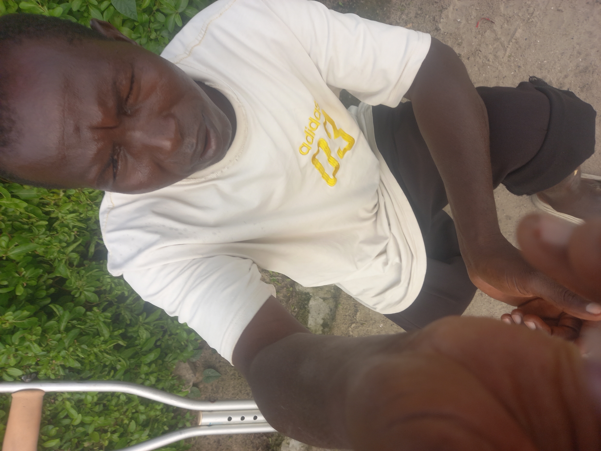 In Ilado, Nigeria, a Black male is depicted sitting outdoors. He is wearing a white t-shirt with yellow Adidas branding and dark pants. He is using a crutch, indicated by a portion of it being visible in the upper left corner of the frame. The man is tending to his foot, with his hands near his toes. The background consists of lush green foliage. The ground appears to be dirt and rough concrete.