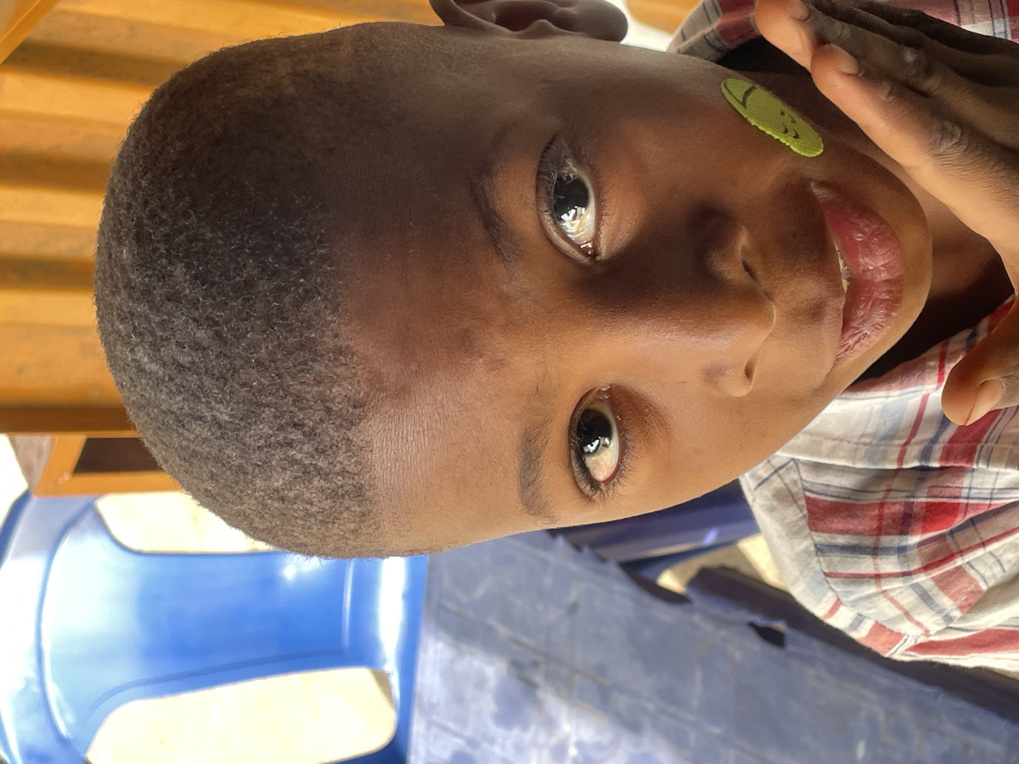 A close-up shot shows a young, dark-skinned individual with short hair, likely a child, looking directly at the camera. A small, green, rectangular sticker with black markings is positioned on the cheek near the mouth. The person is wearing a checkered shirt with red and white patterns. Part of a blue plastic chair is visible in the lower left. The location is Jos, Nigeria.