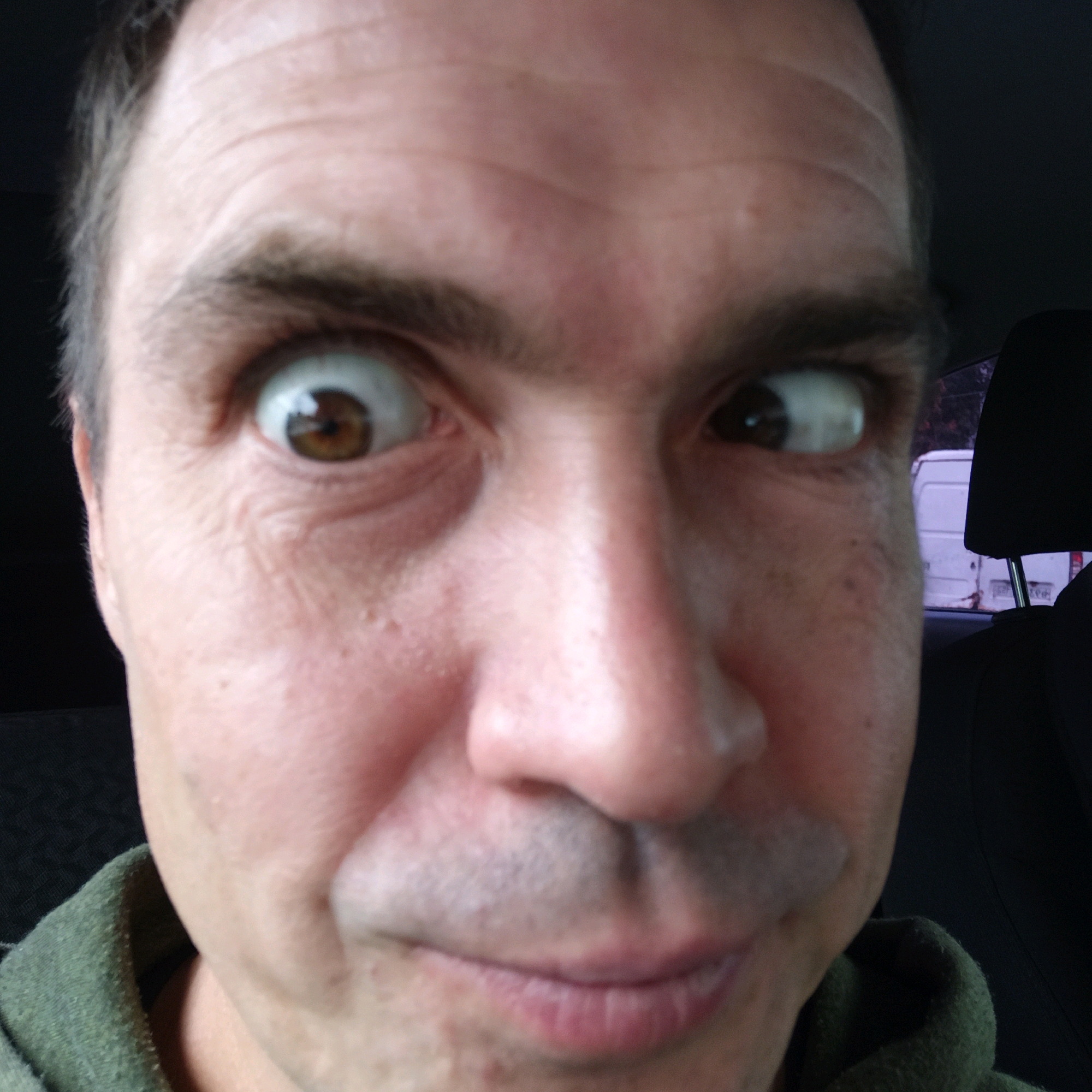The image is a close-up selfie of a person's face, taken from a low angle, presumably from inside a vehicle. The person has light skin, short dark hair, and light brown eyes. Their eyes are wide open and looking in slightly different directions, giving a surprised or startled expression. The left eye is more prominent, showing a reflection of light. The skin has some minor imperfections, such as small bumps and what appear to be freckles or moles. The person is wearing a green hooded sweatshirt. In the background, out of focus, is a dark interior, possibly car upholstery, and a white van with red taillights visible through a window. The scene is not specific to any location in Nizhny Novgorod, Russia, as there are no identifiable landmarks or contextual clues to suggest its geographical origin. The lighting suggests it is daytime, but the exact time of day and weather conditions are not discernible.