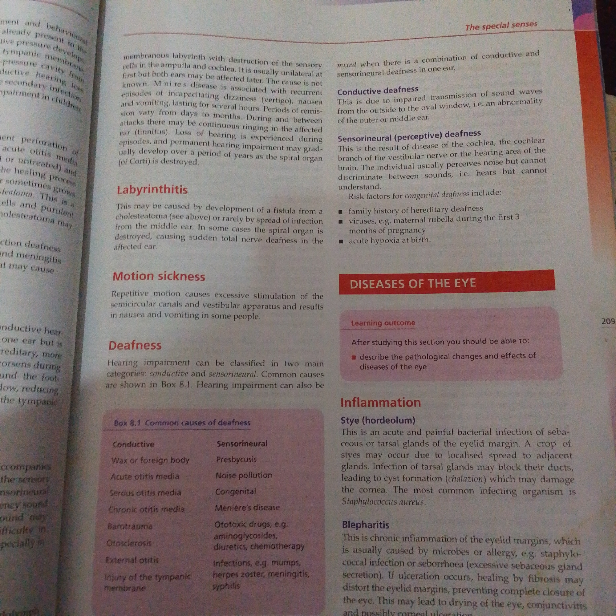 The image displays an open book with text about the human senses, specifically focusing on hearing and eye conditions. The text is divided into sections with headings like "Labyrinthitis," "Motion sickness," "Deafness," and "DISEASES OF THE EYE." There are also tables and bullet points listing causes and symptoms. The book appears to be placed on a flat surface, but the surrounding environment is not visible. The text is in English. The image does not contain any information related to Jalingo, Nigeria.